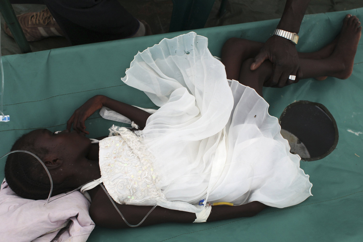 May 27, 2014. A South Sudanese girl suffering from cholera lies in a bed in Juba Teaching Hospital in Juba.