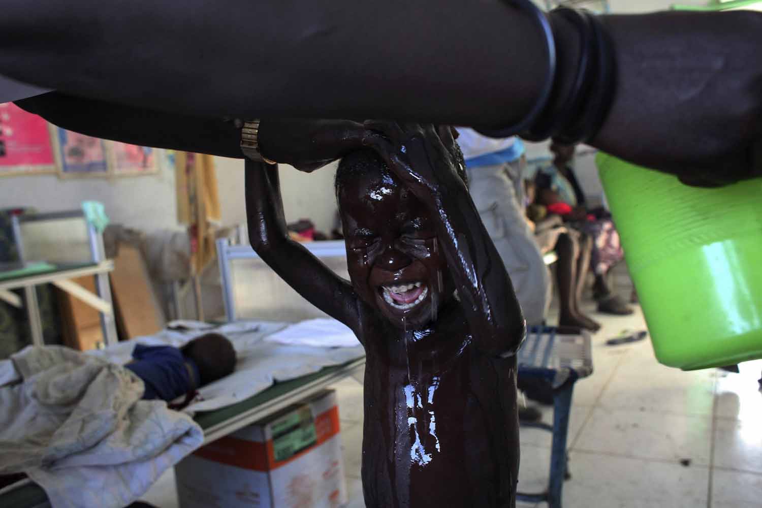 May 28, 2014. A South Sudanese child displaced by the fighting in Malakal, and suffering from malnutrition, cries as he is washed by a nurse at a feeding centre run by Medicins sans Frontiers (MSF) in Kodok, Fashoda county, South Sudan.