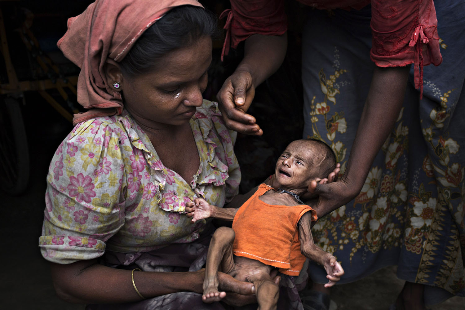 Rohingya Refugees Face Health Crisis As Myanmar Cuts Off Aid
