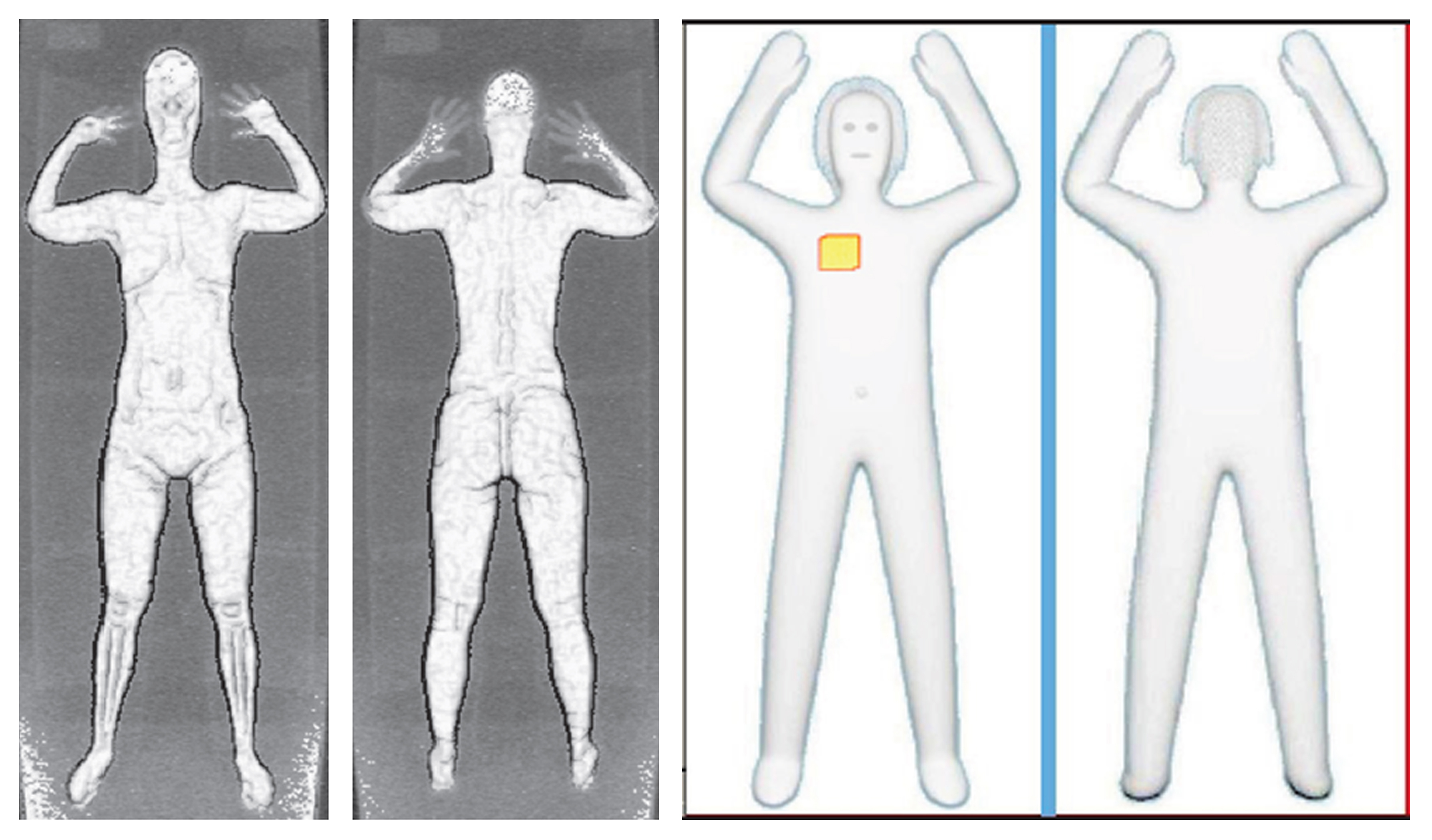 These two sets of images provided by the Transportation Security Administration are samples that show details of what TSA officers see on computer monitors when passengers pass through airport body scanners. (Transportation Security Administration/AP)