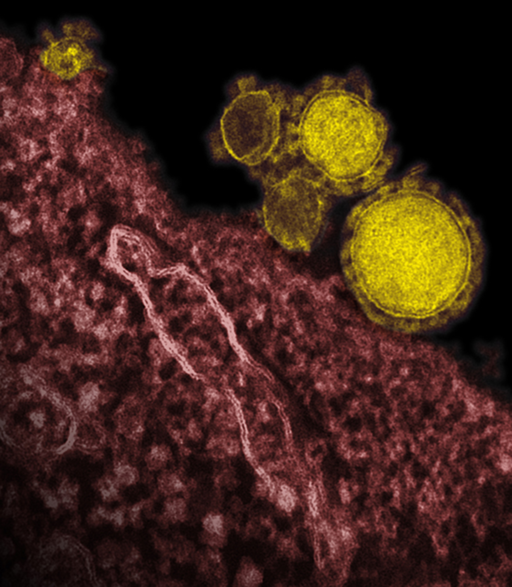 This undated file electron microscope image made available by the National Institute of Allergy and Infectious Diseases - Rocky Mountain Laboratories shows novel coronavirus particles, also known as the MERS virus, colorized in yellow. (AP)