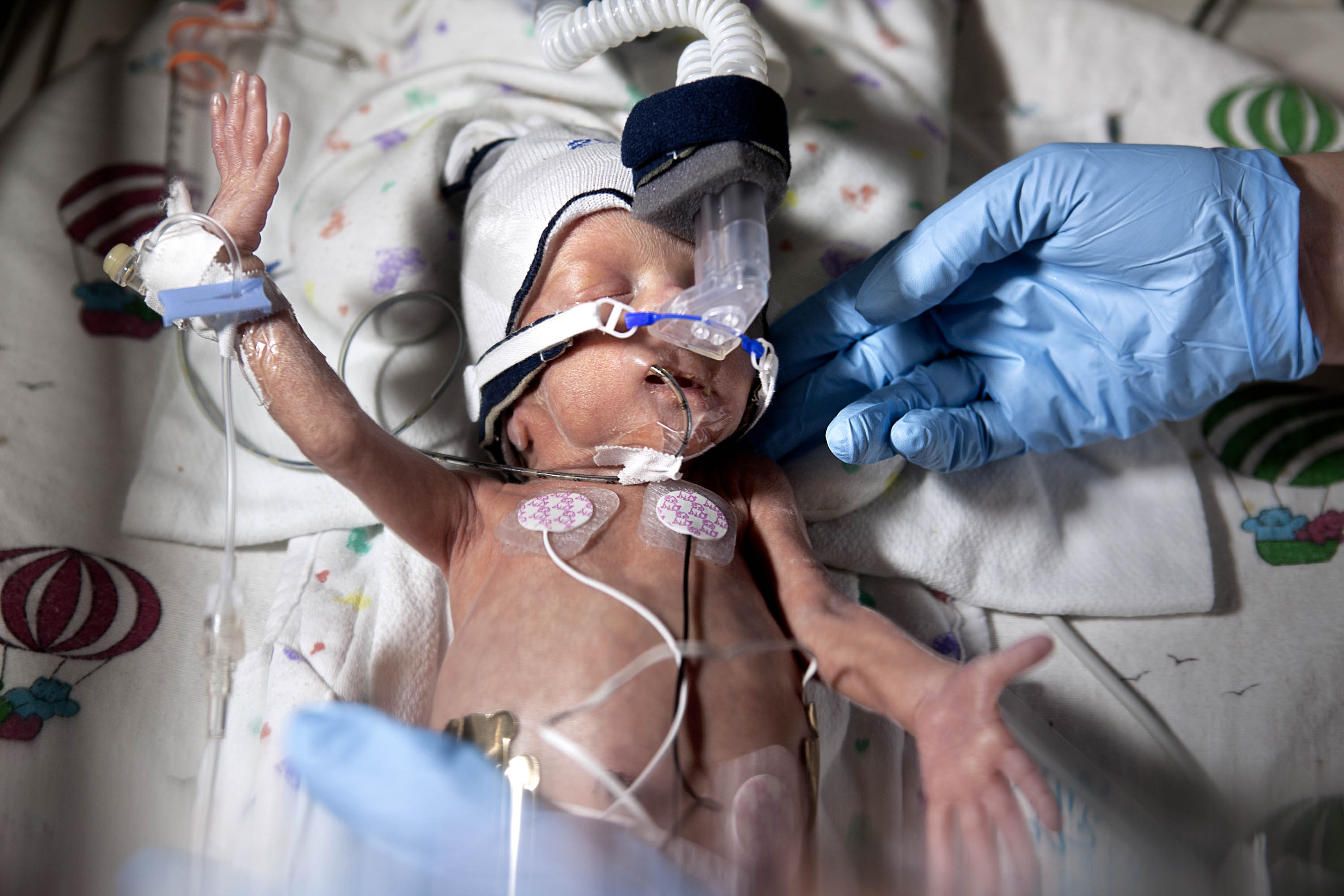 A Preemie Revolution  Cutting-edge medicine and dedicated  caregivers are helping the  tiniest babies survive— and thrive
