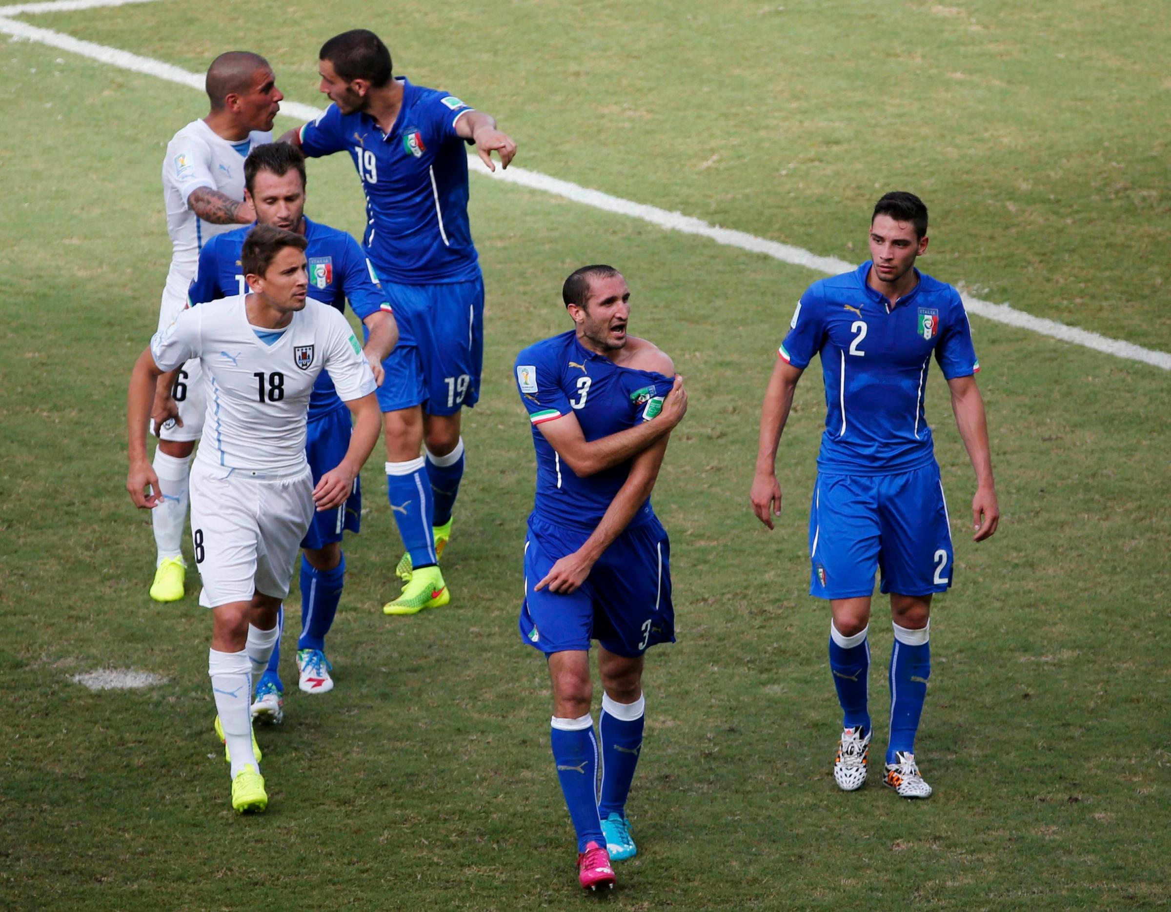 Italy's Giorgio Chiellini shows his shoulder, claiming he was bitten by Uruguay's Luis Suarez, during their 2014 World Cup Group D soccer match at the Dunas arena in Natal, Brazil on June 24, 2014.