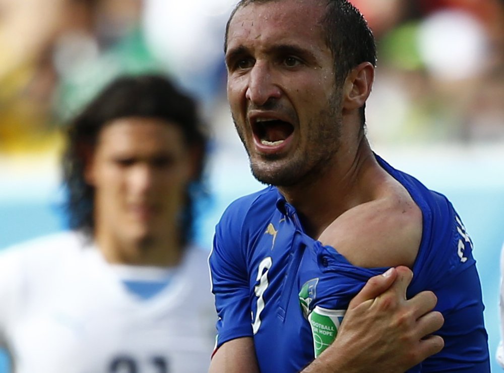 Italy's Giorgio Chiellini shows his shoulder, claiming he was bitten by Uruguay's Luis Suarez, during their 2014 World Cup Group D soccer match at the Dunas arena in Natal, Brazil on June 24, 2014.
