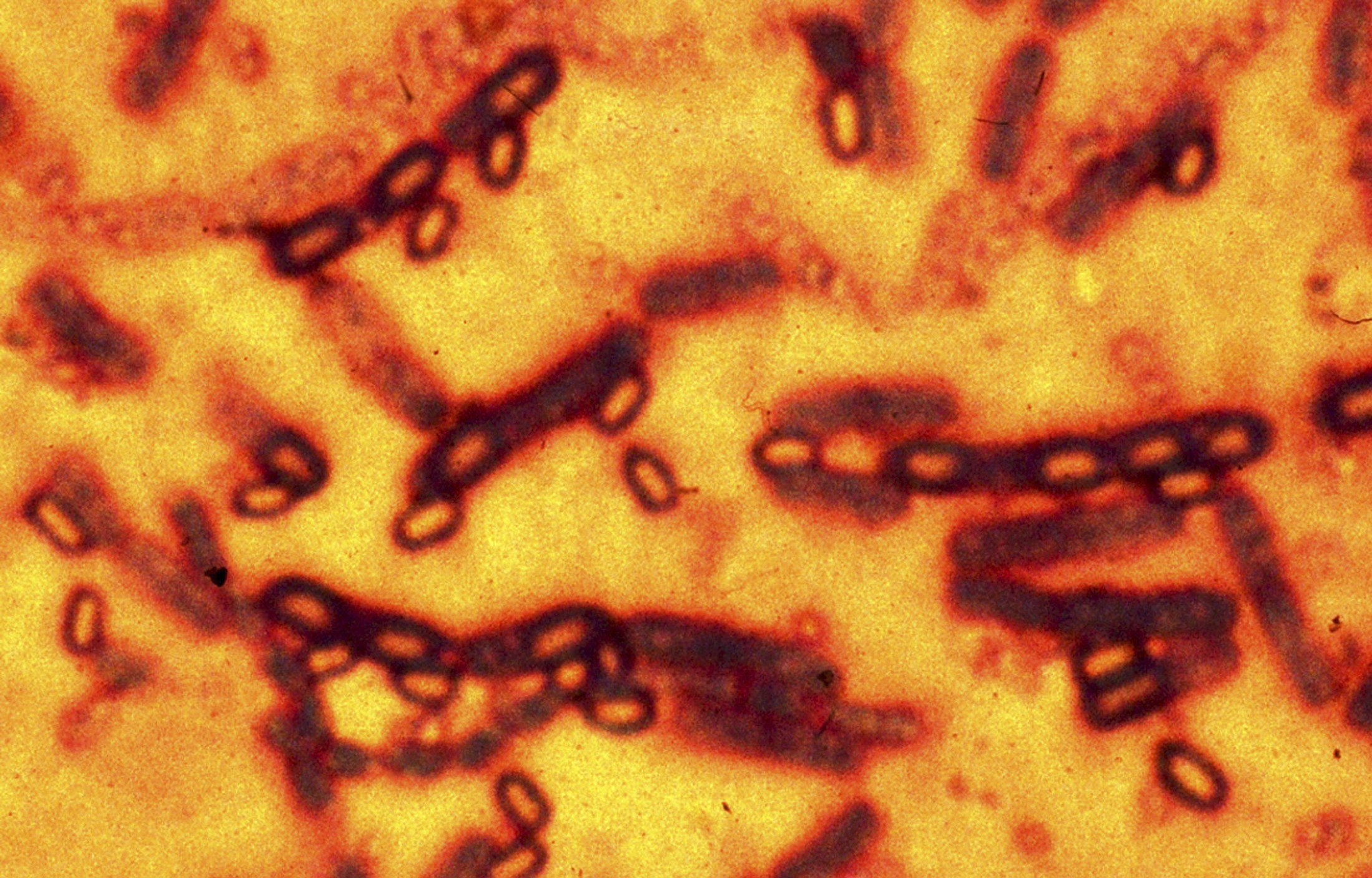 A microscopic picture of spores and vegetative cells of Bacillus anthracis which causes the disease anthrax. (Reuters)