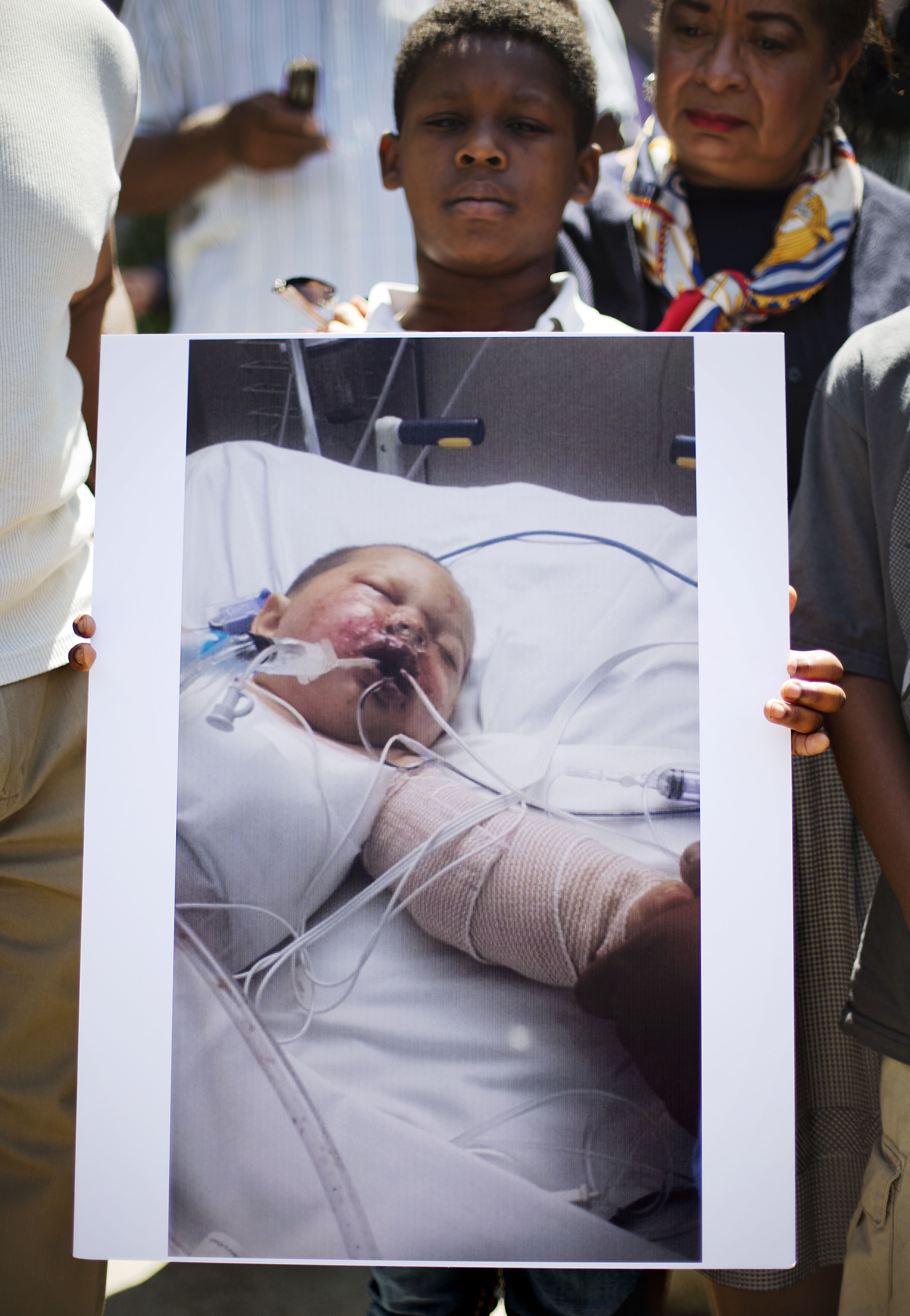 A photo of 19-month-old Bounkham Phonesavanh, who was severely burned by a flash grenade during a SWAT drug raid, is held by a supporter outside Grady Memorial Hospital in Atlanta on June 2, 2014 (David Goldman—AP)