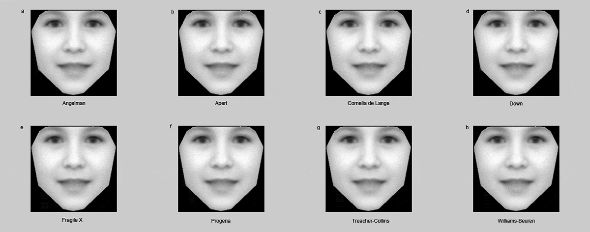 facial recognition