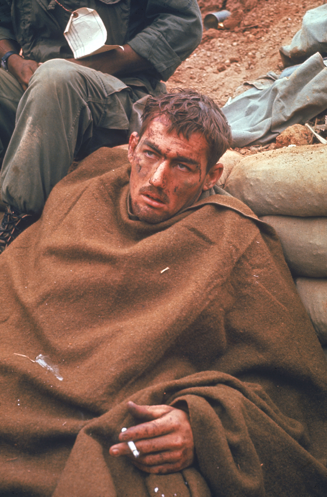 Wounded, dazed-looking American, Vietnam, 1968.