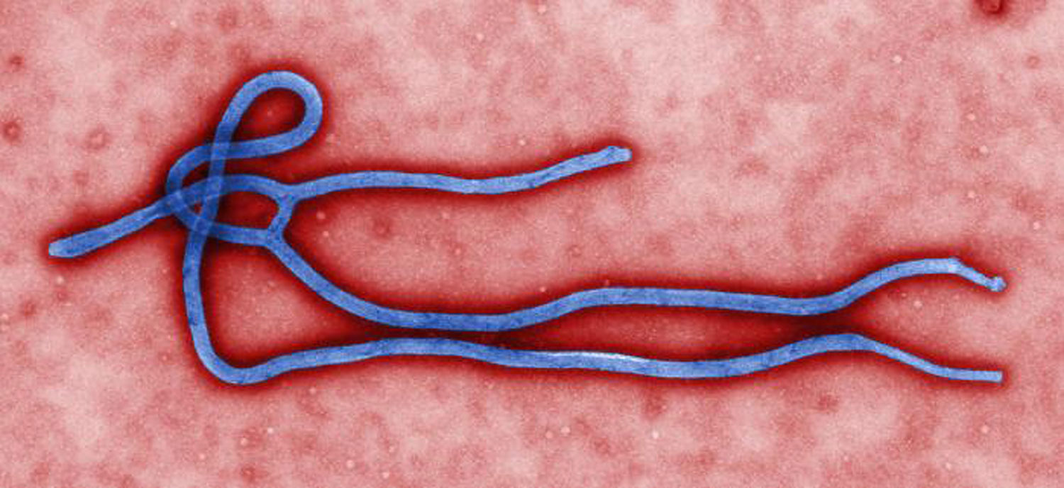 The Ebola virus in an undated photo provided by the Centers for Disease Control and Prevention (CDC/AP)