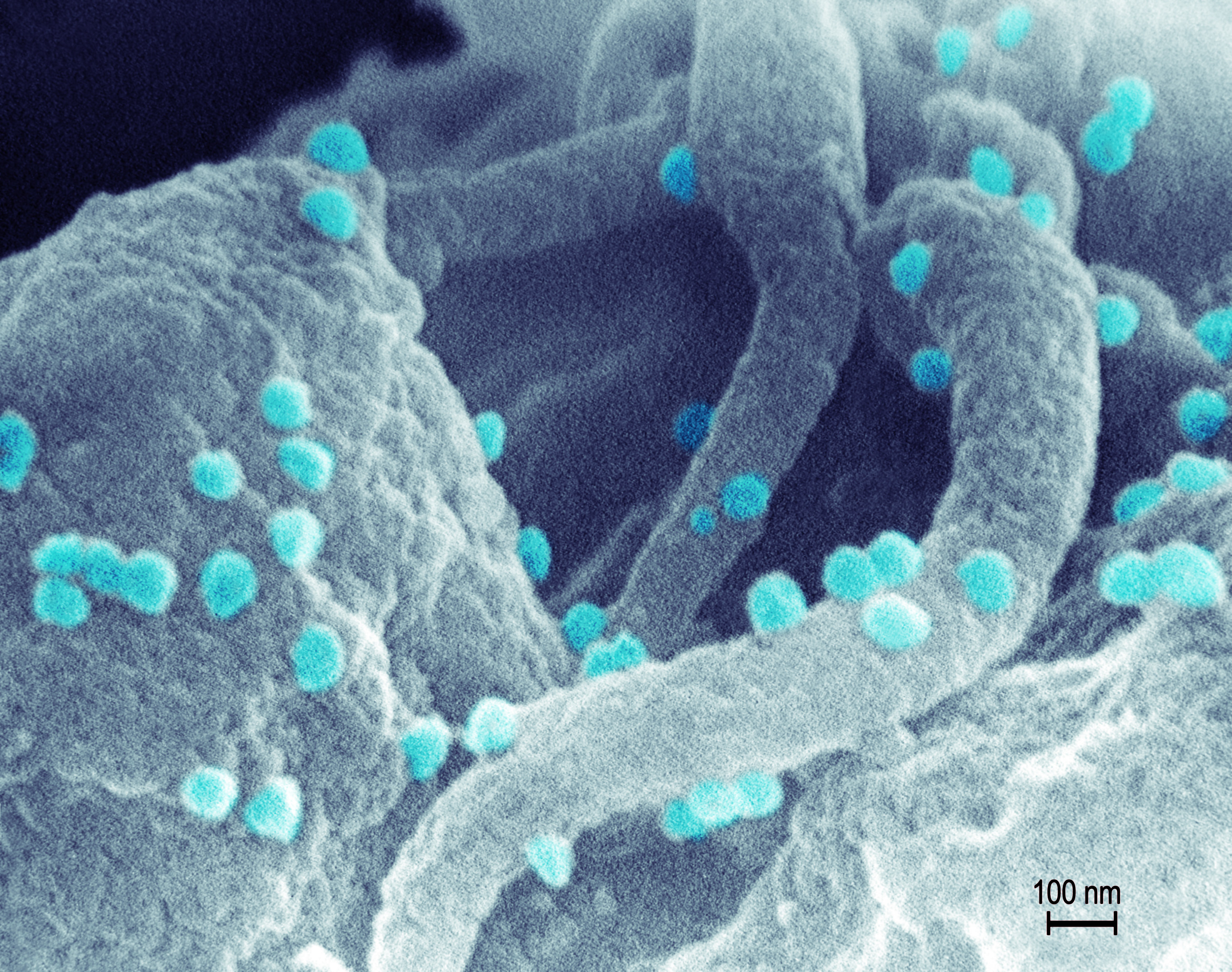Scanning electron micrograph of HIV-1