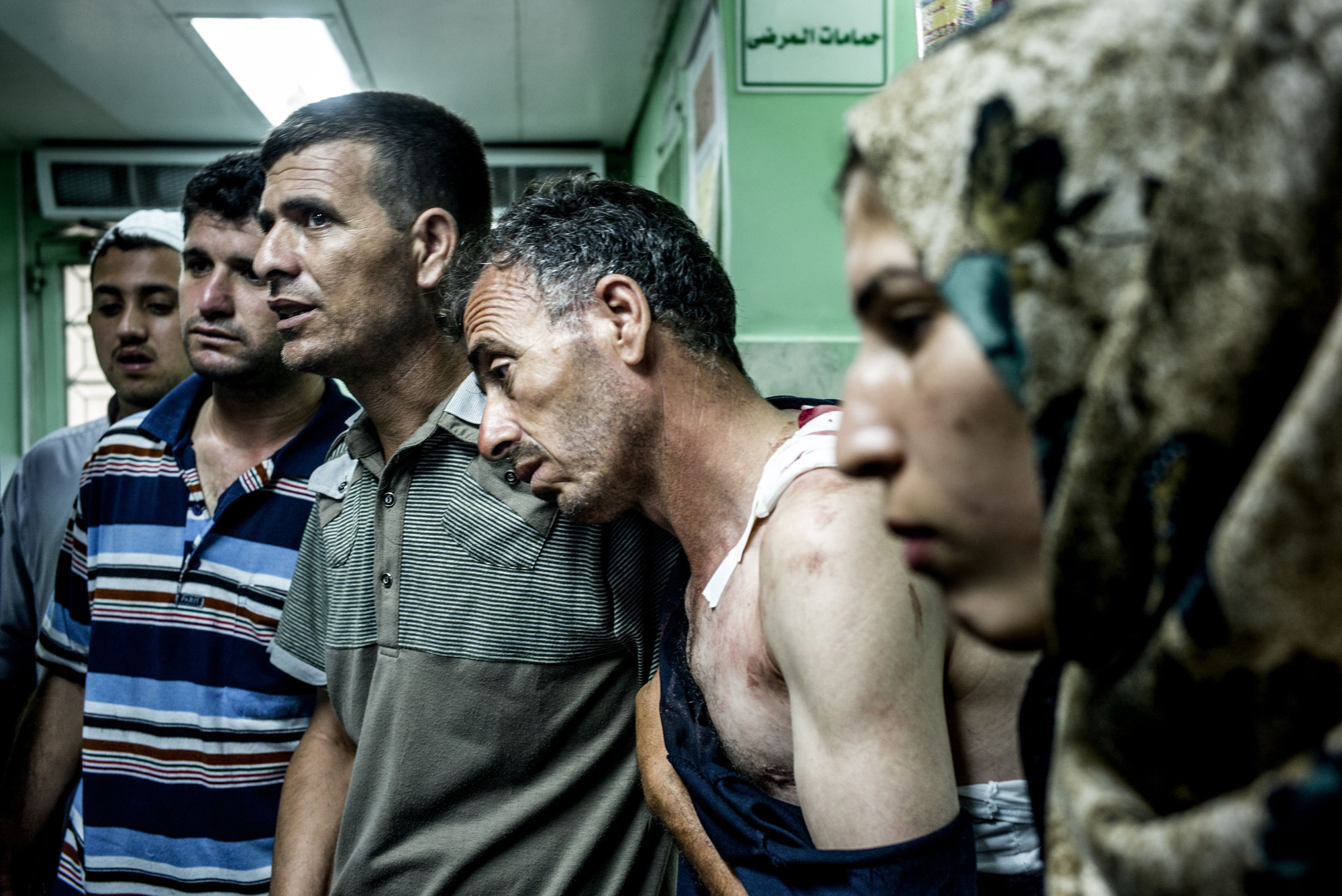 Palestinian civilians wounded during Israeli shelling of a U.N. school wait at the Kamal Odwan Hospital in northern Gaza Strip on July 30, 2014 (Marco Longari—AFP/Getty Images)