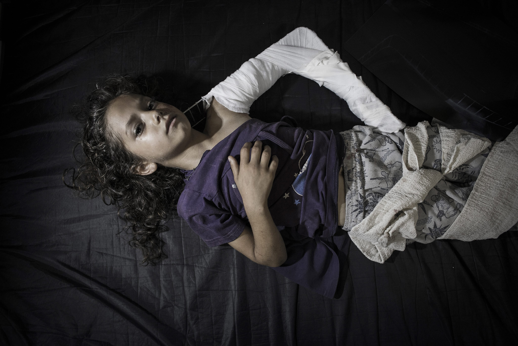 A young Palestinian girl who got injured when a UN school for refugees was allegedly hit by a Israeli tank shells, lies on a hospital bed in the emergency room of Kamal Adwan hospital in Beit Lahiya, Gaza Strip, July 24, 2014.