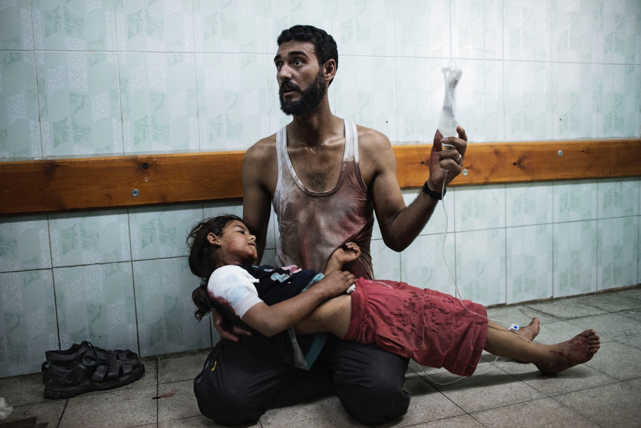 A Palestinian man holds a girl injured during shelling at a U.N.-run school sheltering Palestinians, at a hospital in the northern Gaza Strip on July 24, 2014.