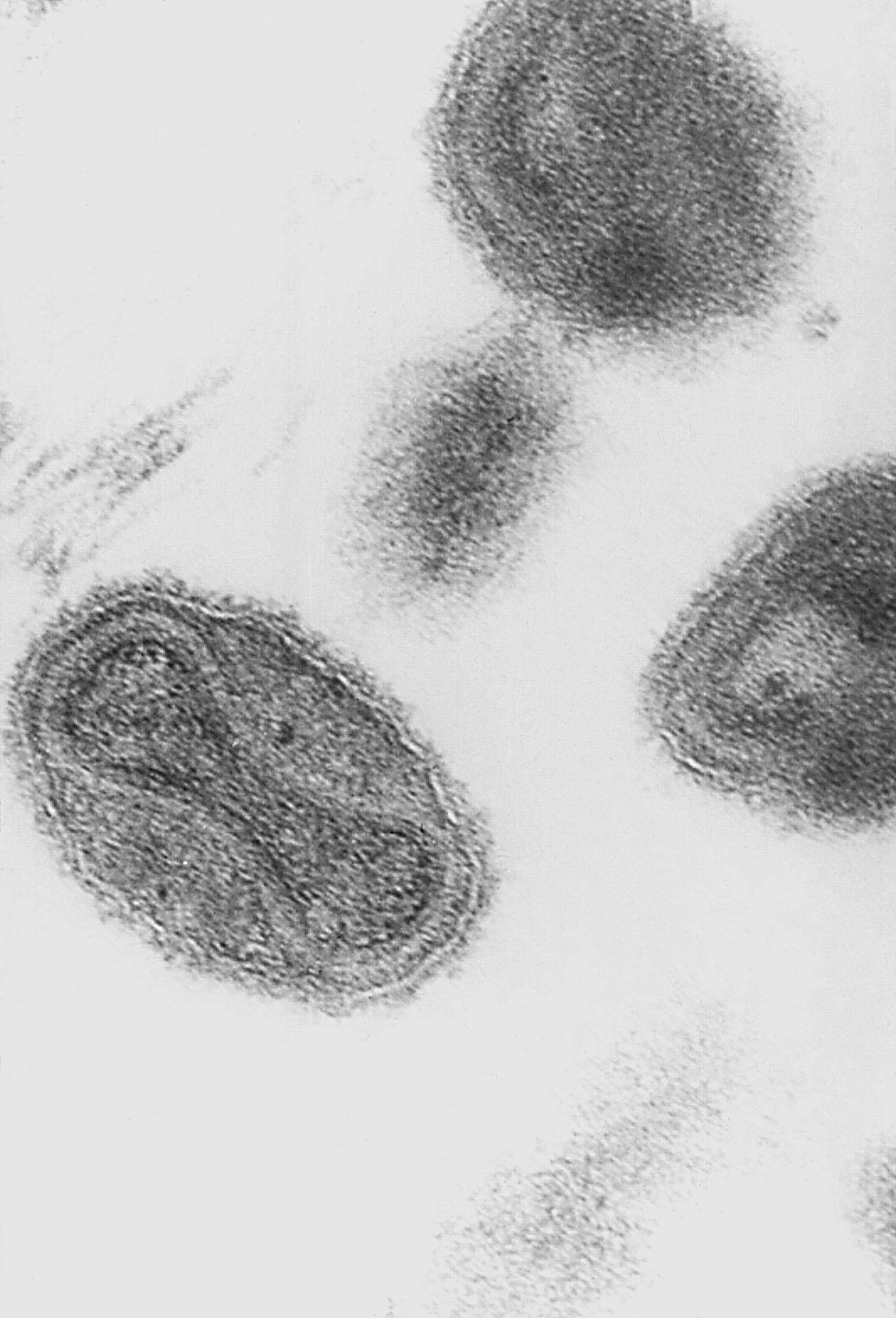 An electron micrograph of the smallpox virus in 1975 (Getty Images)