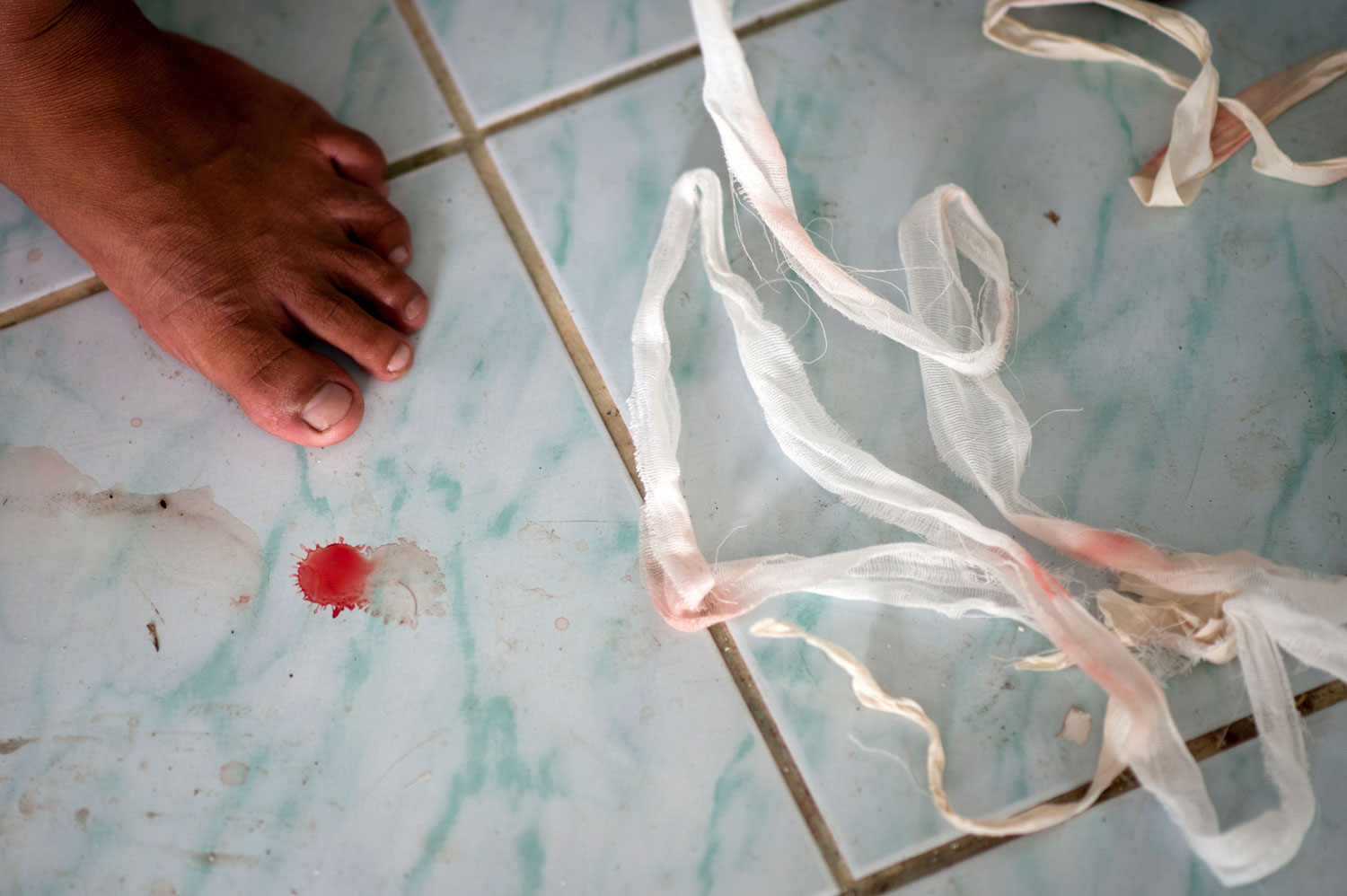 An inmate's foot is seen beside a drop of blood and bandage after a fight at Klong Pai prison on July 12, 2014 in Nakhon Ratchasima, Thailand.