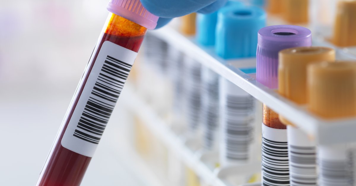 How Much Does a Blood Test Cost? Maybe 10,000 Time