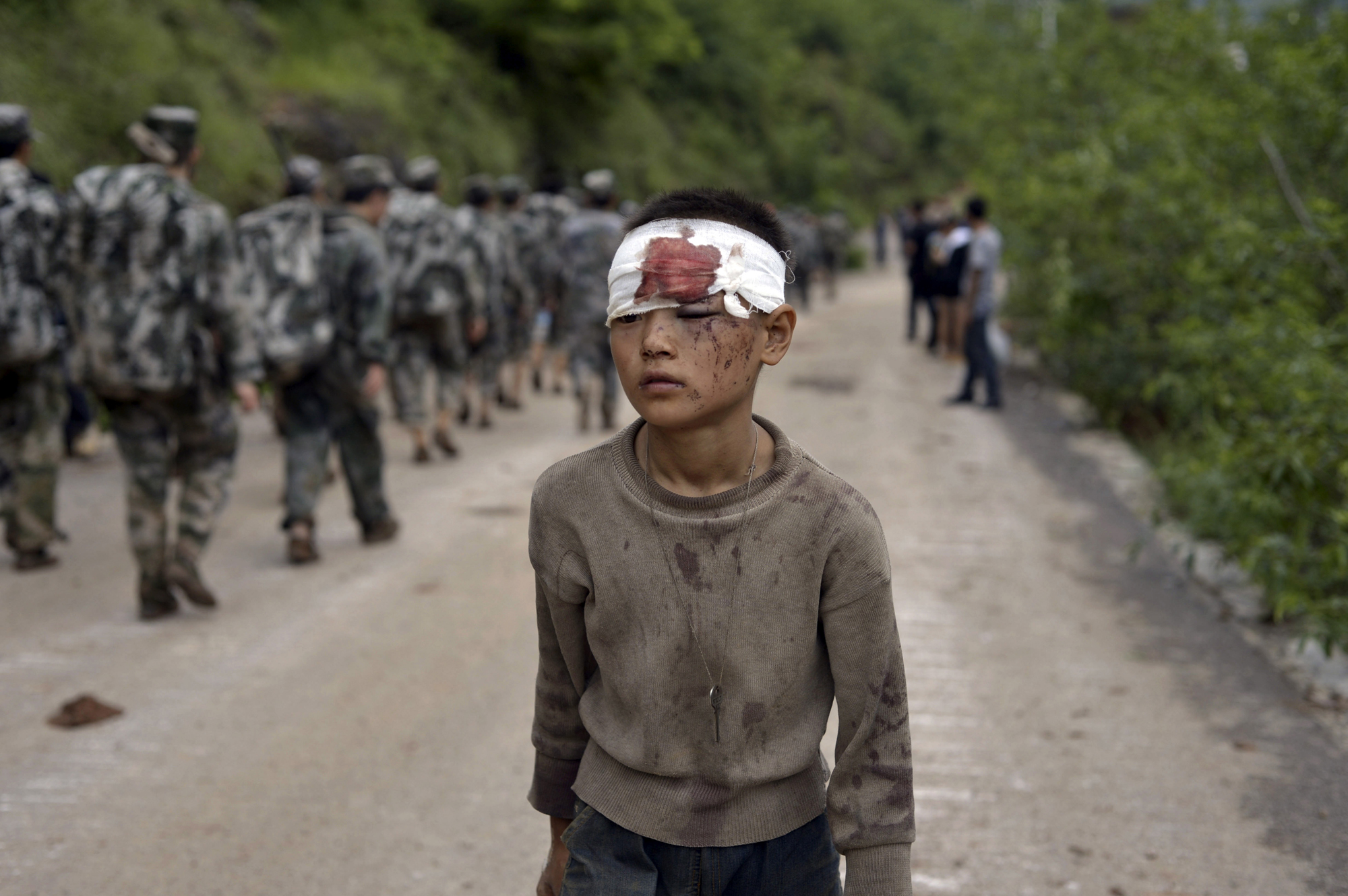 An injured child walks past rescuers heading towards the epicenter of an earthquake that struck the town of Longtoushan in Ludian county in southwest China's Yunnan province, Aug. 4, 2014