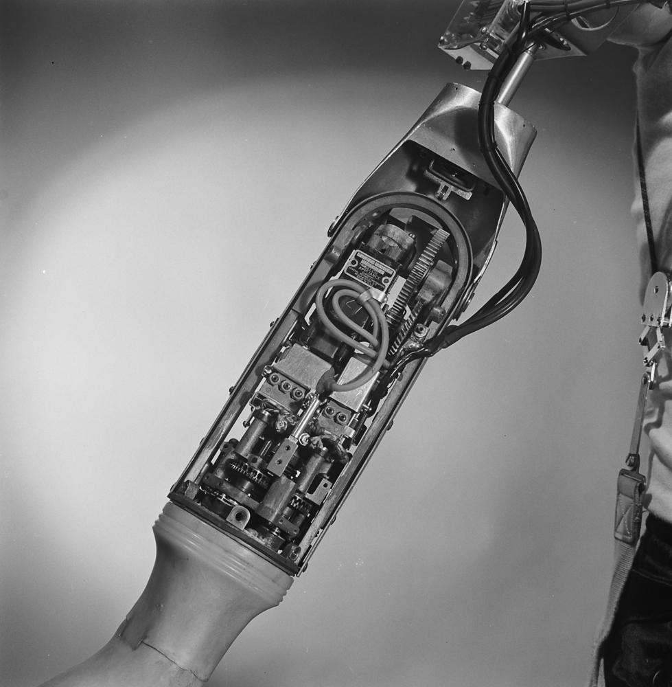 Inner workings of a battery-powered artificial arm and hand, 1950.