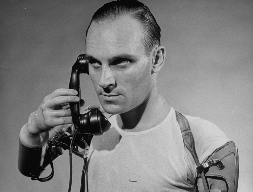 An amputee holds a telephone to his ear using a battery-powered artificial arm, 1950.