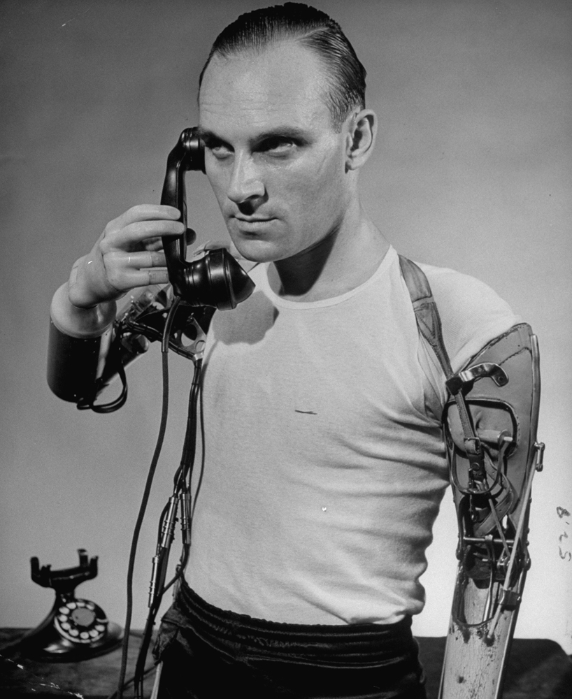 An unidentified man holds a telephone to his ear using a battery-powered artificial arm and hand, 1950.