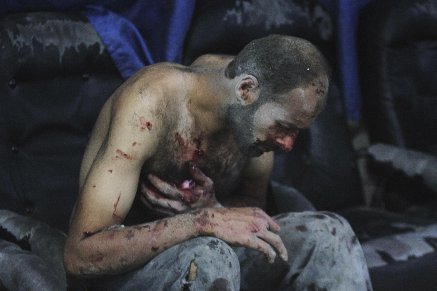 Sept. 9, 2014. An injured man sits at a field hospital after what activists said were airstrikes by forces loyal to Syria's President Bashar al-Assad, in the Duma neighbourhood of Damascus.