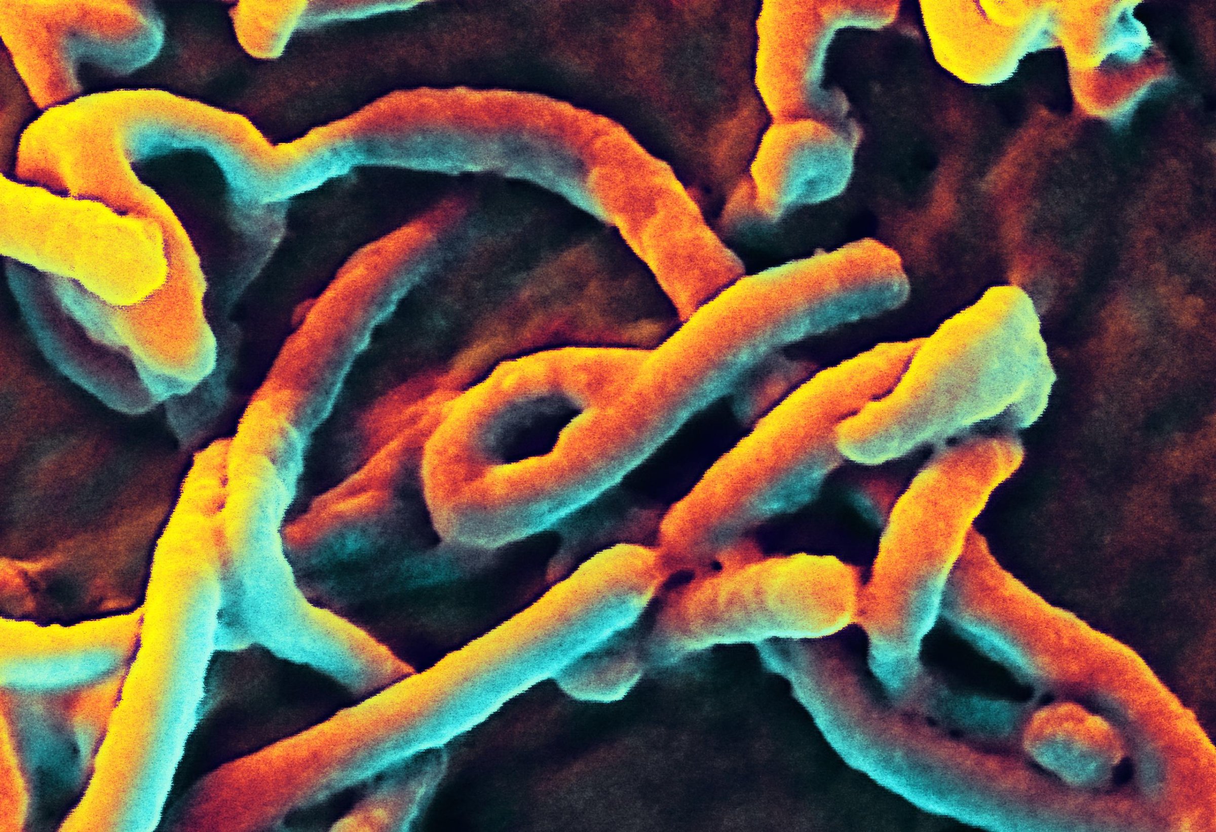 A scanning electron micrograph of Ebola virus budding from the surface of a Vero cell of an African green monkey kidney epithelial cell line.