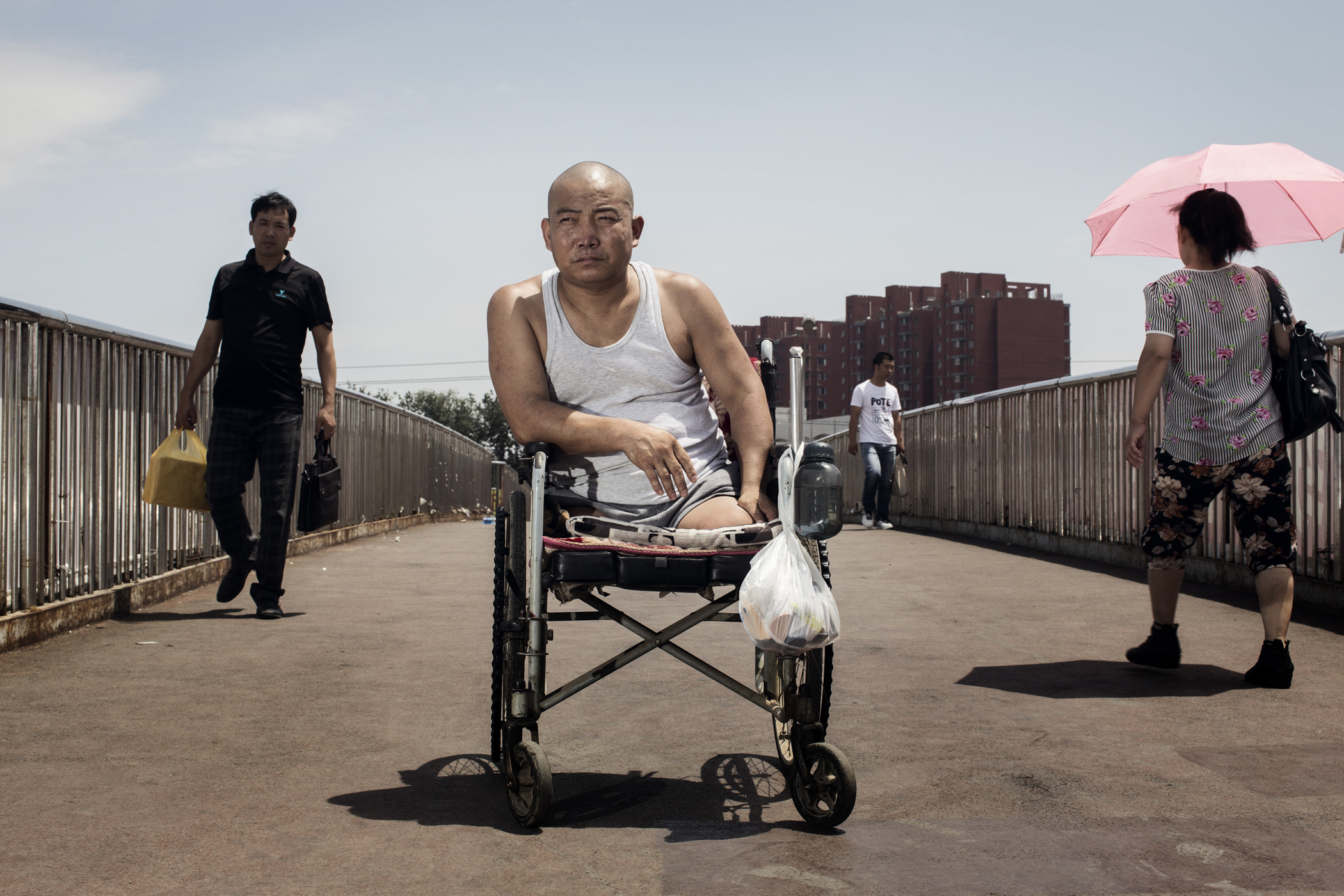 Hebei farmer Zheng currently in Beijing where he is having prothesis made. July 2014.