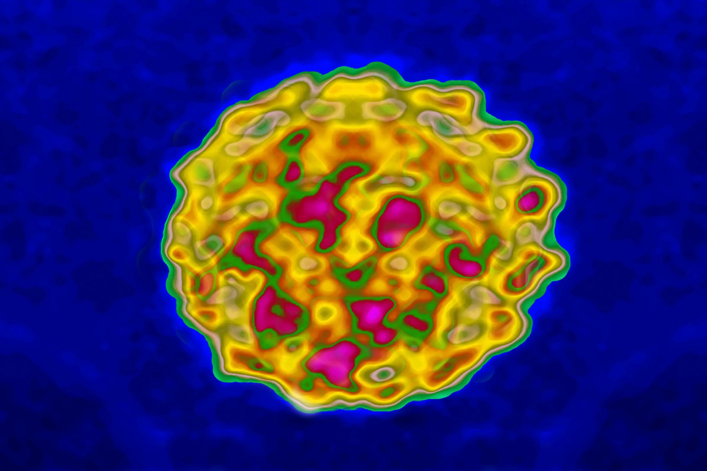 A representation of the Papilloma Virus(HPV) based on an electronic microscope magnification At 300000X.