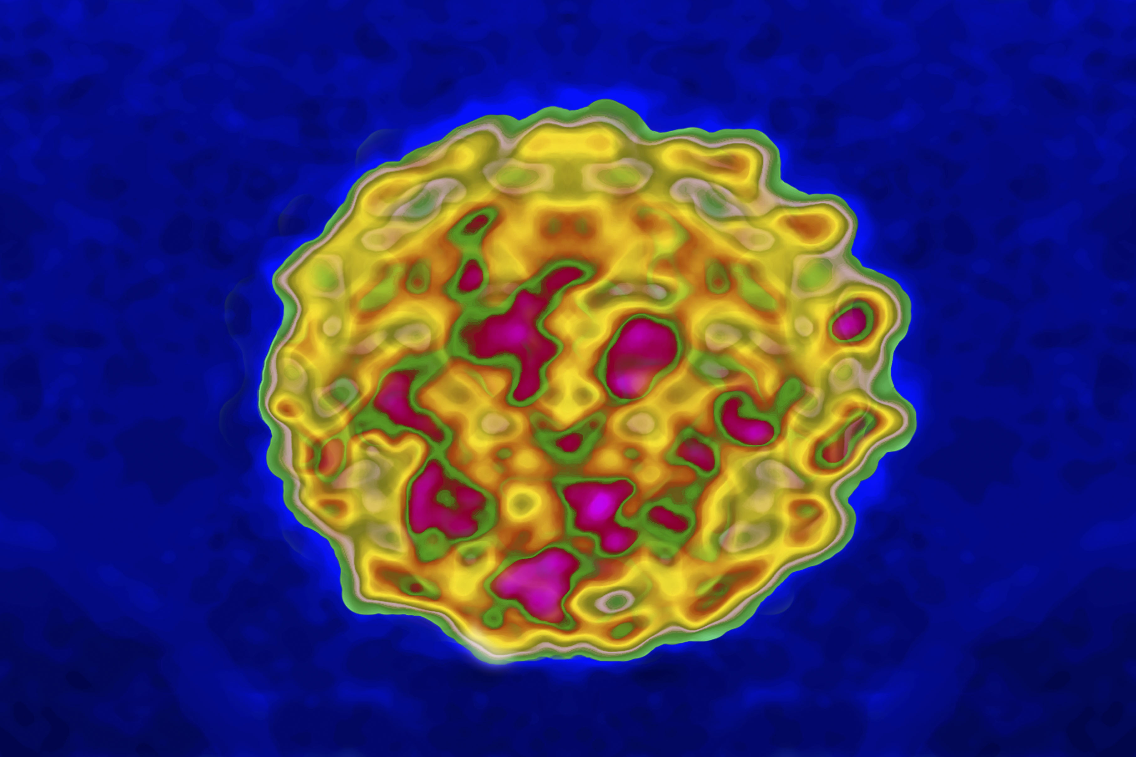 A representation of the Papilloma Virus(HPV) based on an electronic microscope magnification At 300000X. 