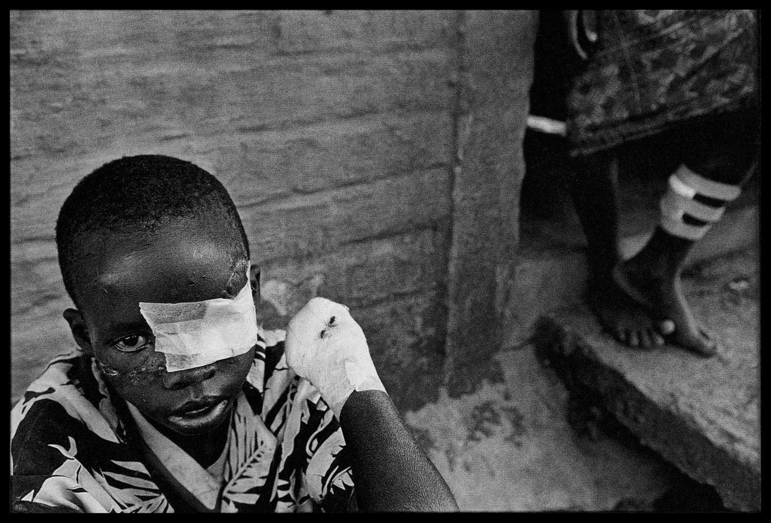 At the Red Cross clinic in Nyanza. Tutsis who had been freed from the death camp were treated for their wounds, Rwanda, 1994.