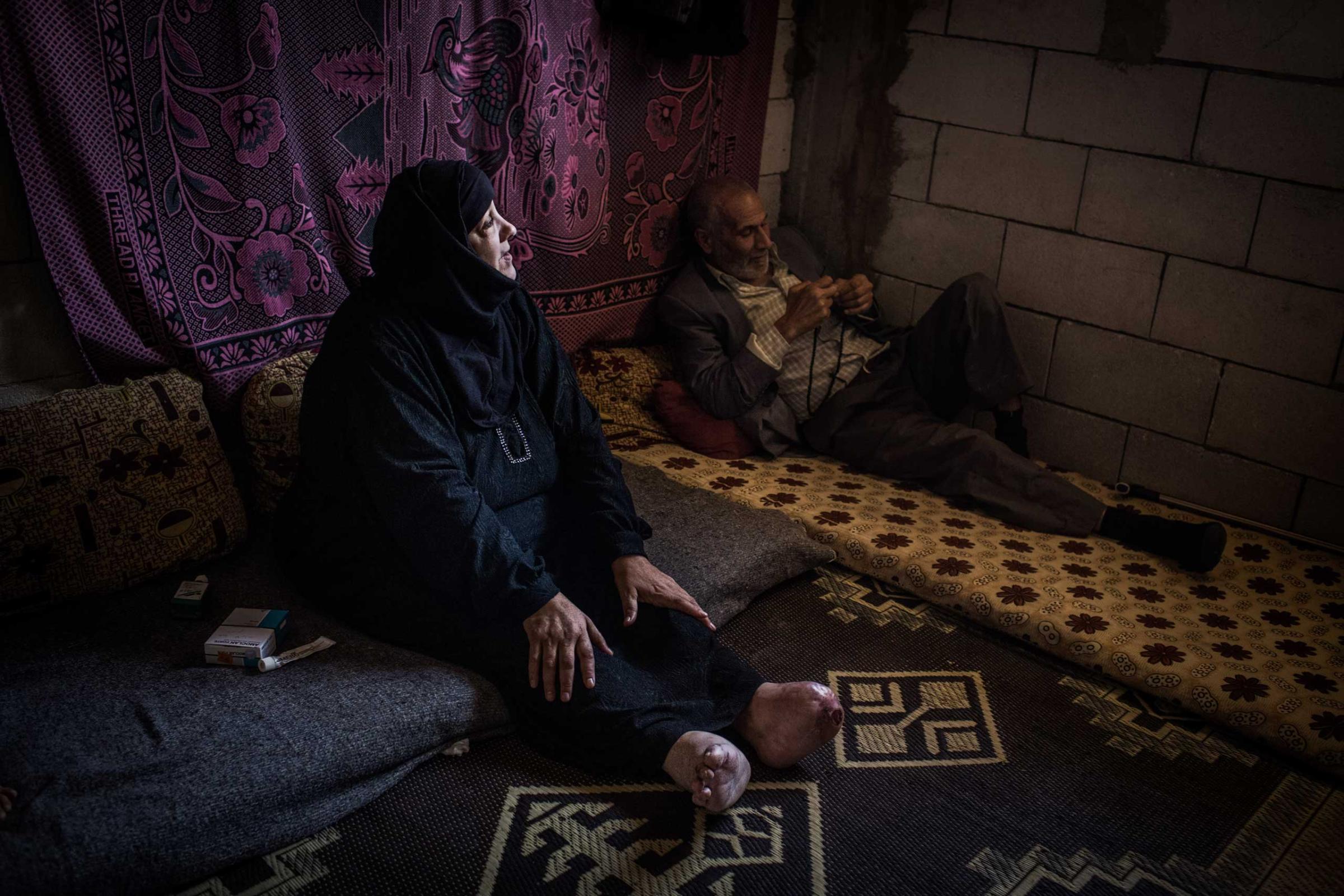 Sabah, 57, at home in the Bekaa Valley, Lebanon, June 26, 2014. Sabah, who has diabetes, was home when a neighbor’s house was bombed. Several toes were amputated after a glass wound: “I haven't walked in two years."