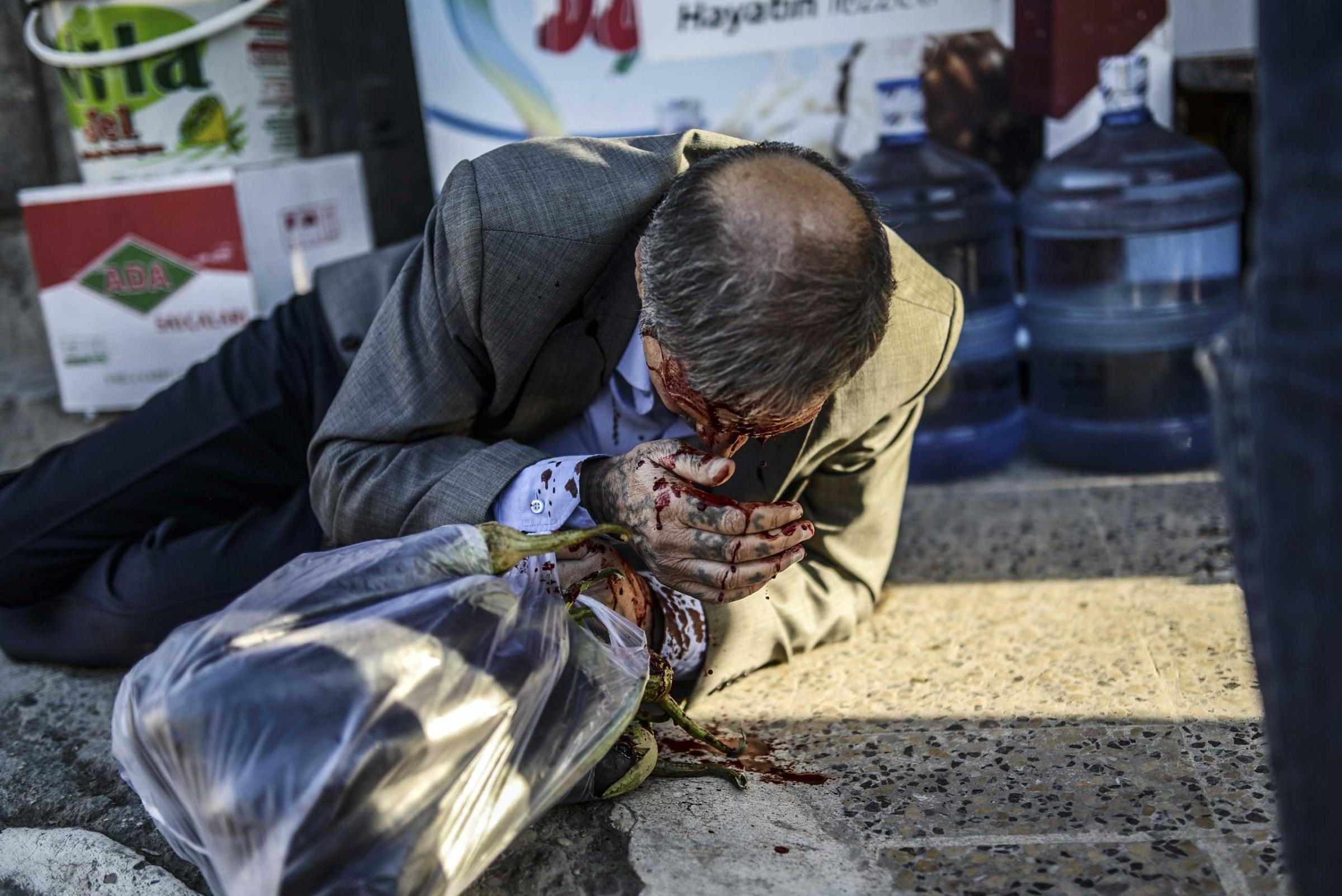 A Kurdish man bleeds after being injured while walking in the center of Suruc during clashes between protestors and Turkish riot policemen after authorities temporarily closed the border at the southeastern town of Suruc in Sanliurfa province, on Sept. 22, 2014.