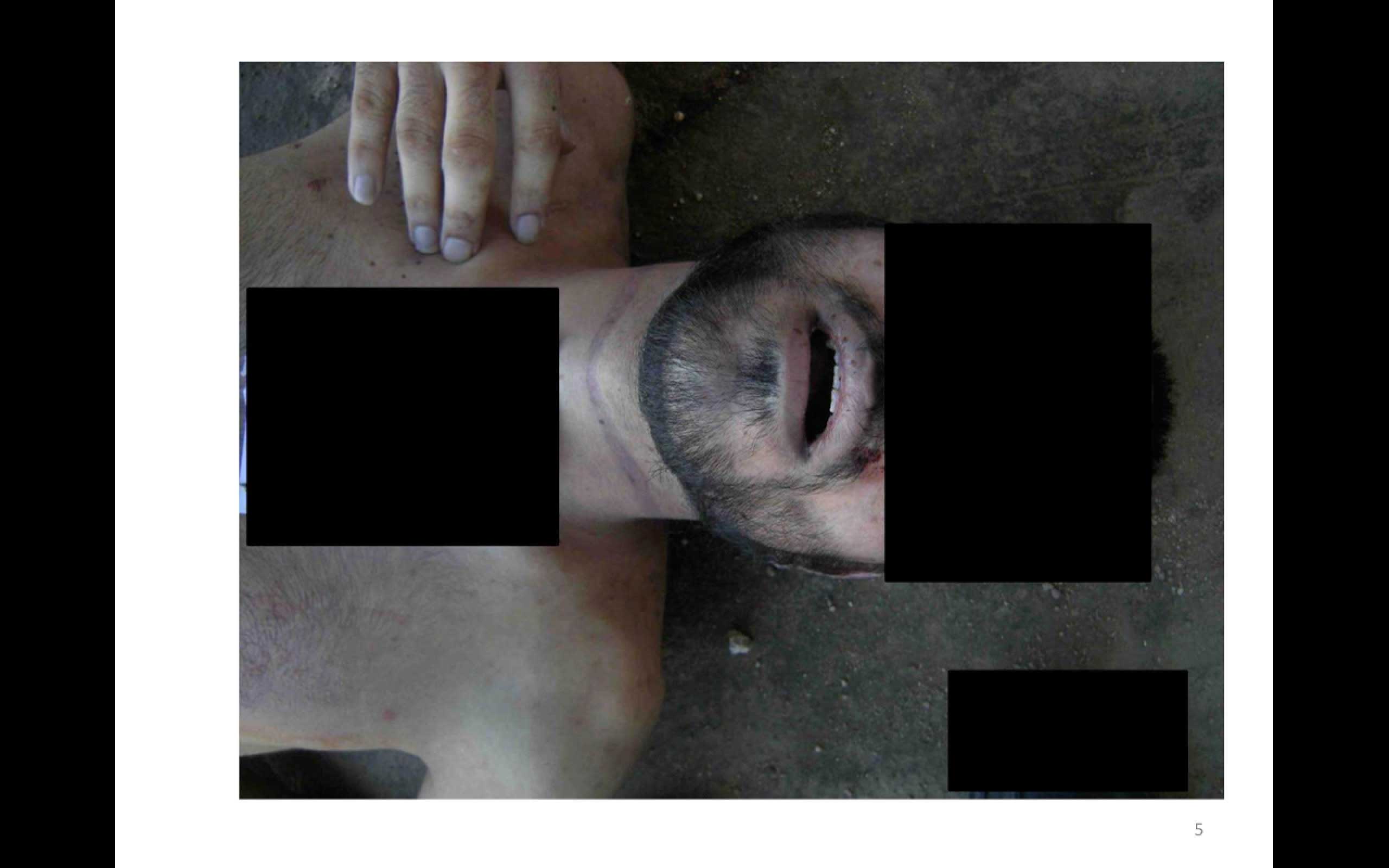 This undated photograph made available in a January 2014 report by the Carter-Ruck law firm, commissioned by the Qatari government, shows evidence of alleged torture and execution at the secret jails of Syria's president, Bashar al-Assad. It is part of an archive of 55,000 images said to depict 11,000 dead bodies photographed over the last two years and leaked to Syrian opposition forces by a Syrian military photographer.