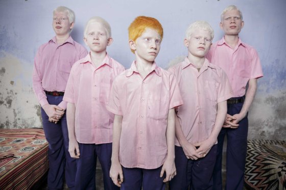1st Prize People – Staged Portraits Single. 25 September 2013, West Bengal India. A group of blind albino boys photographed in their boarding room at the Vivekananda mission school for the blind in West Bengal, India. This is one of the very few schools for the blind in India today.