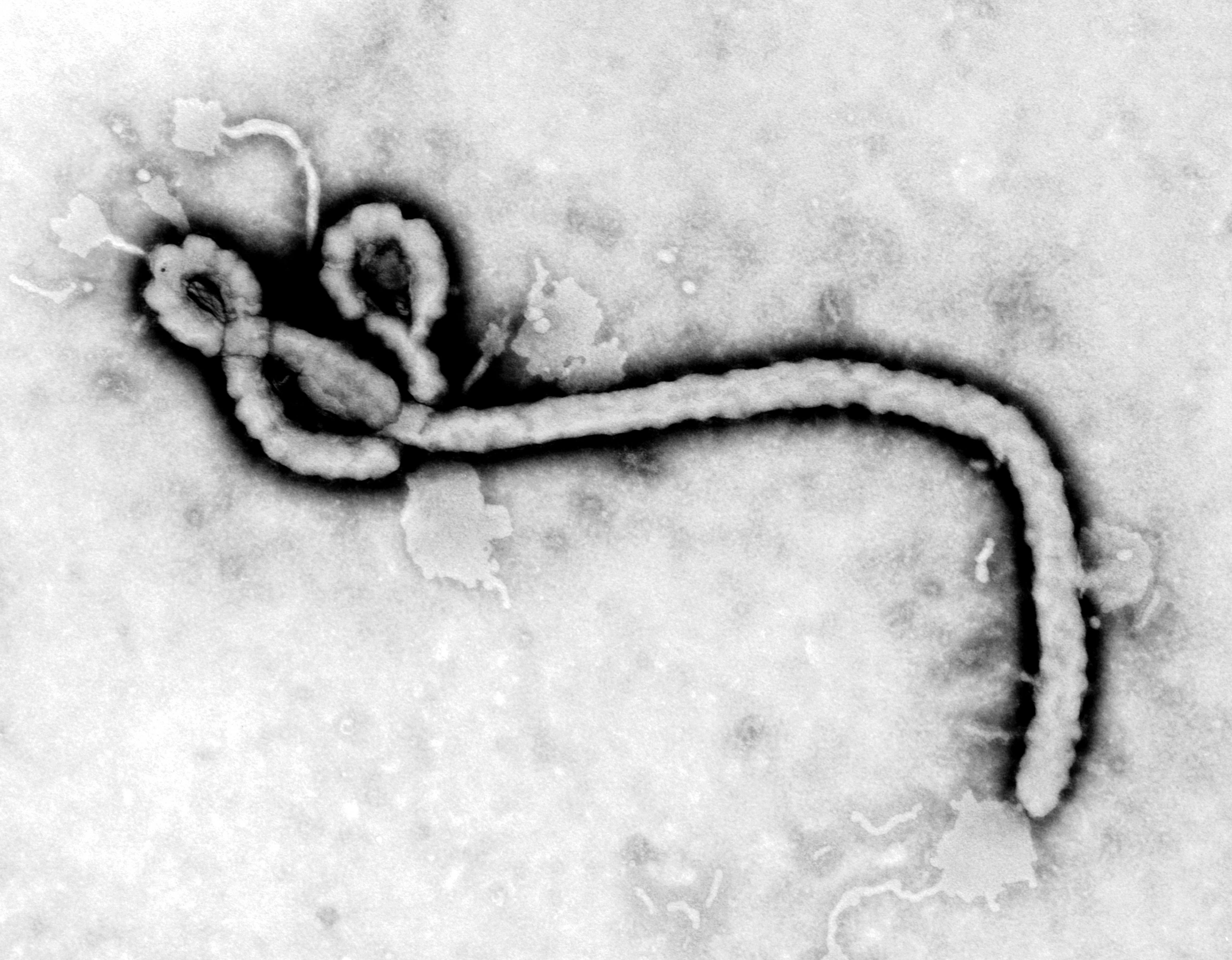 Transmission Electron Micrograph (TEM) of the Ebola virus