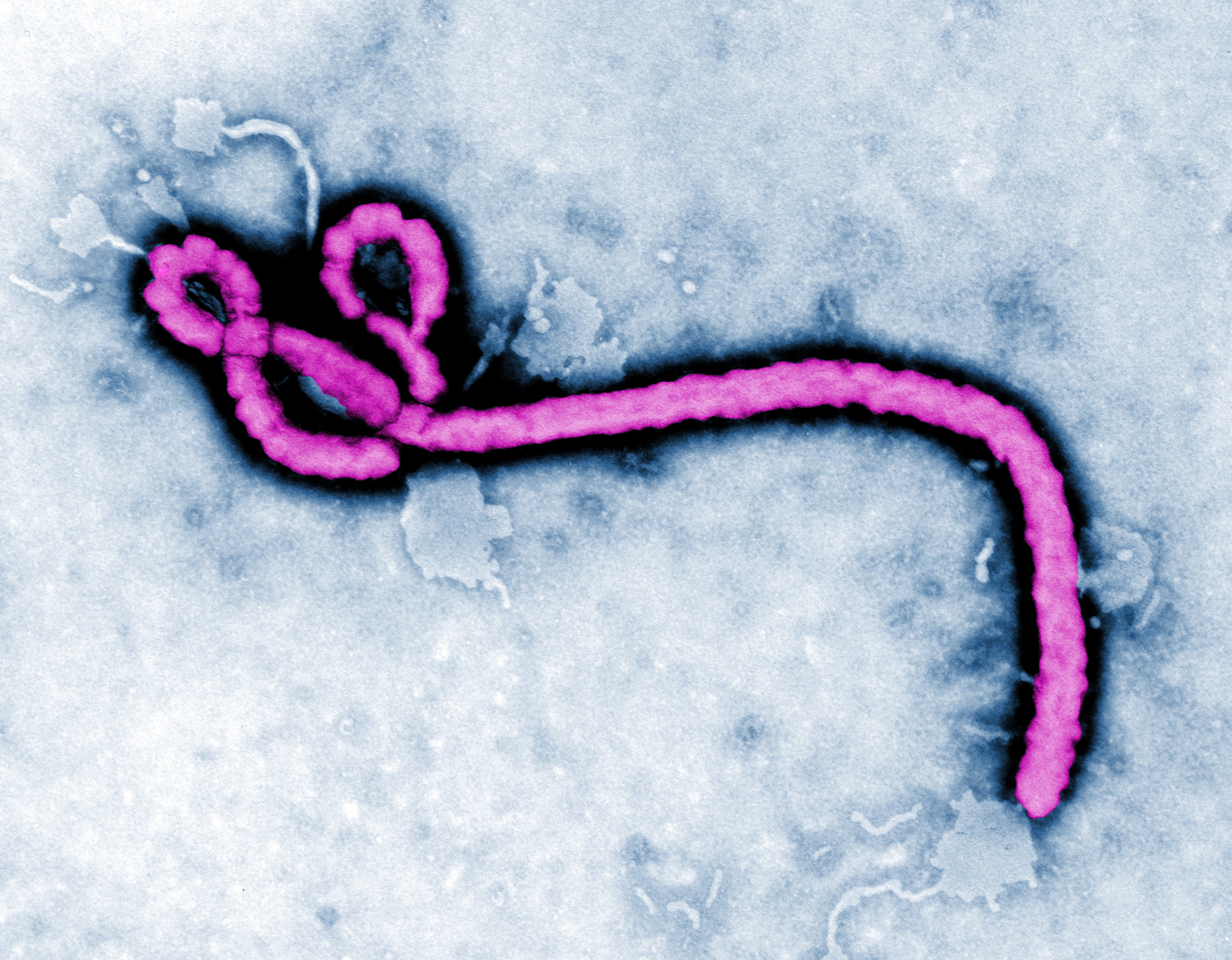 Colorized transmission electron micrograph (TEM) of the Ebola virus.