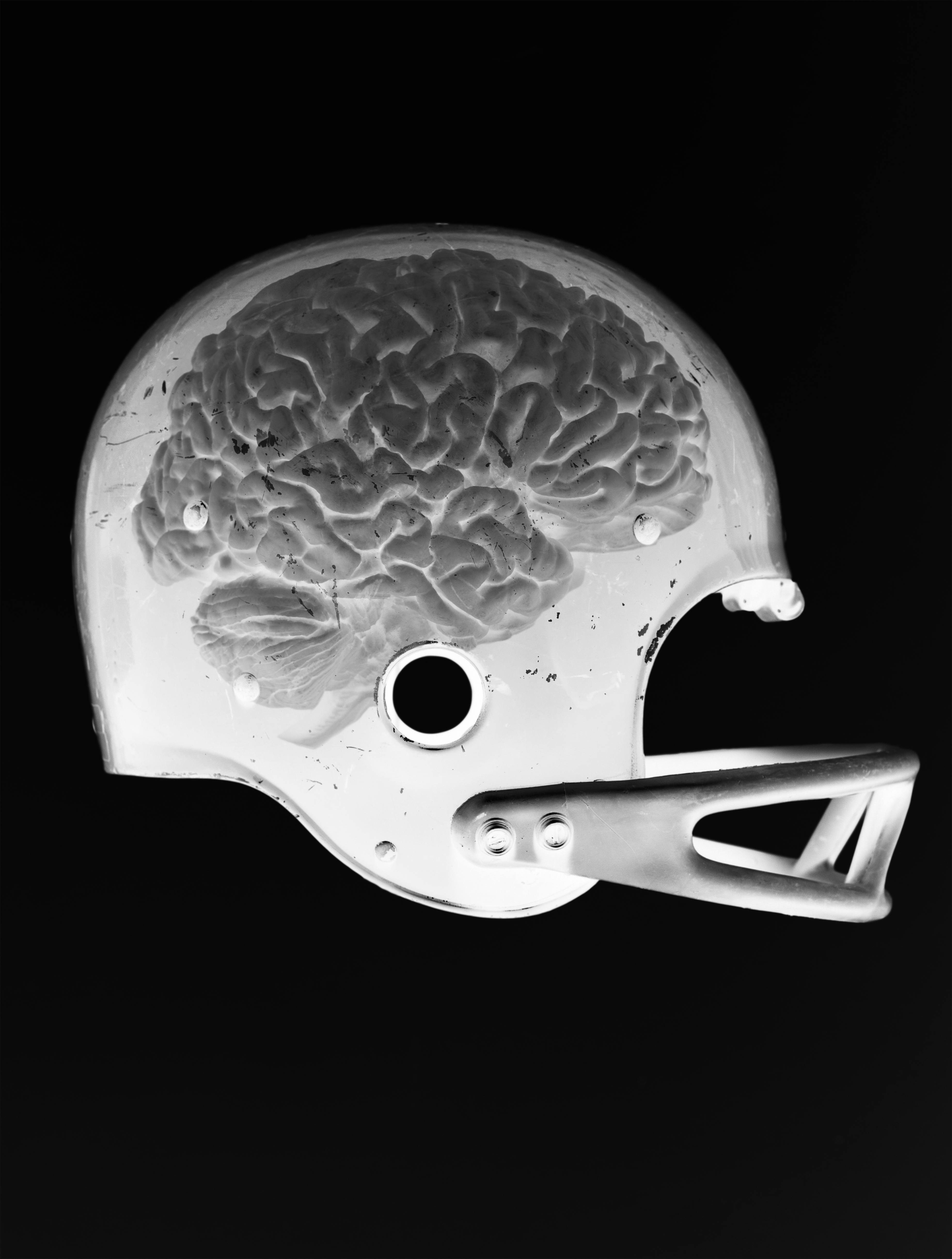 helmet football concussion