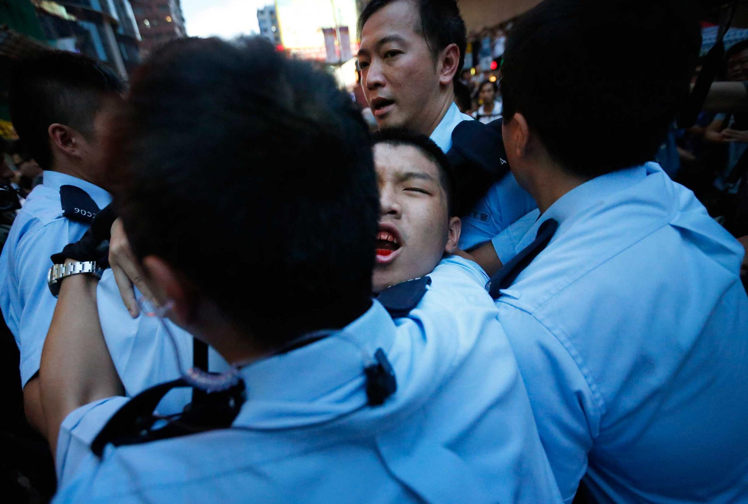 A student protester is injured after being pulled off and hit by residents and pro-Beijing supporters while local police are escorting him out of the protest area in Kowloon's crowded Mong Kok district, Oct. 3, 2014 in Hong Kong.