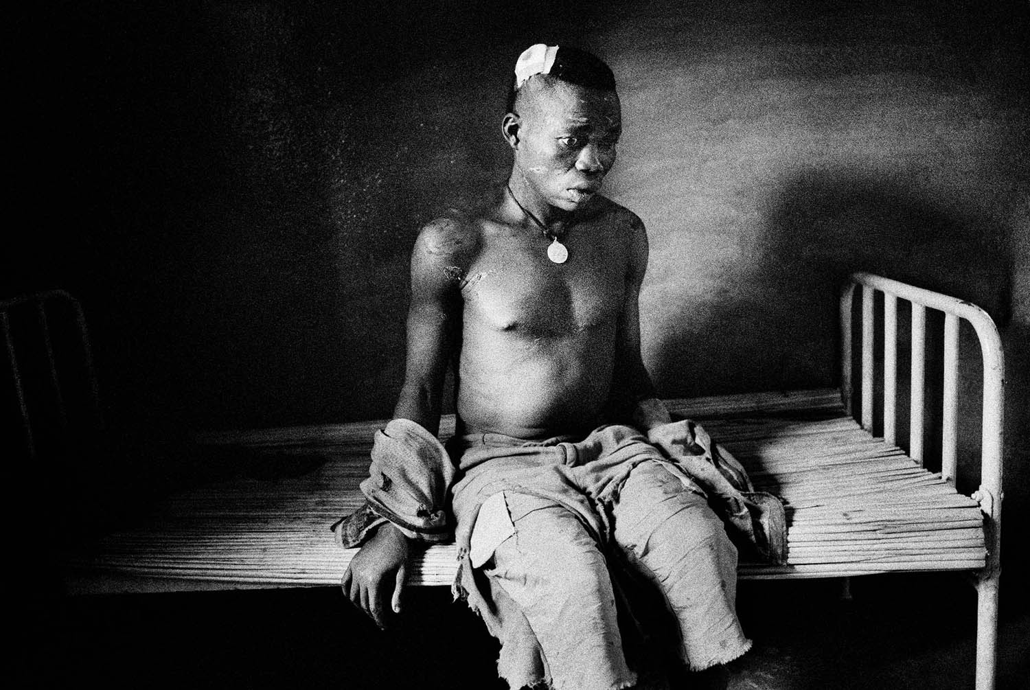 A militia soldier lies in a makeshift hospital in Dro Dro. The militia in the area have been accused of being cannibals by the local population. This militia soldier was captured and beaten by the local population. Democratic Republic of Congo. 2003.