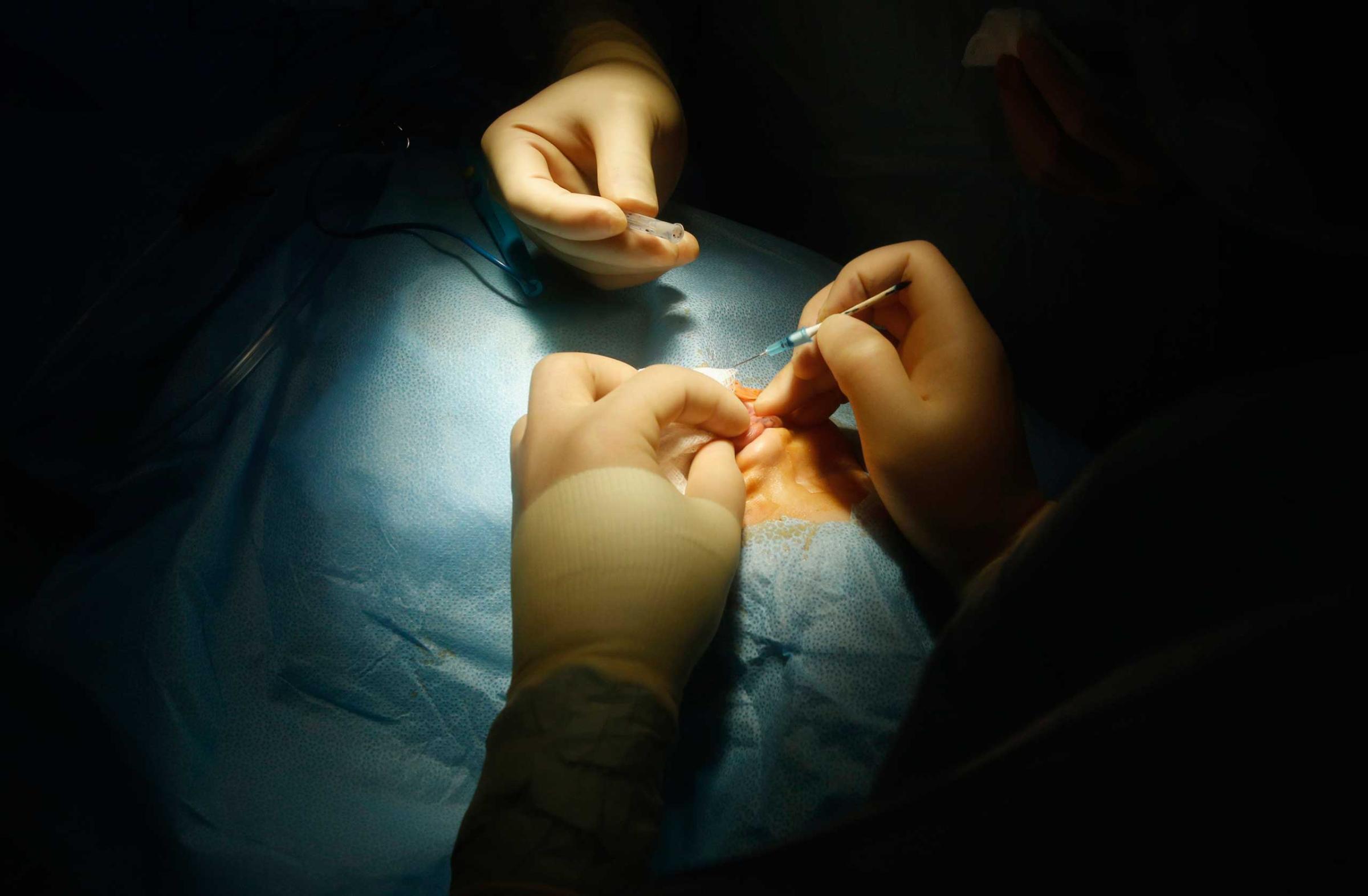 Doctors perform a surgery at the Vietnam Cuba hospital in Hanoi