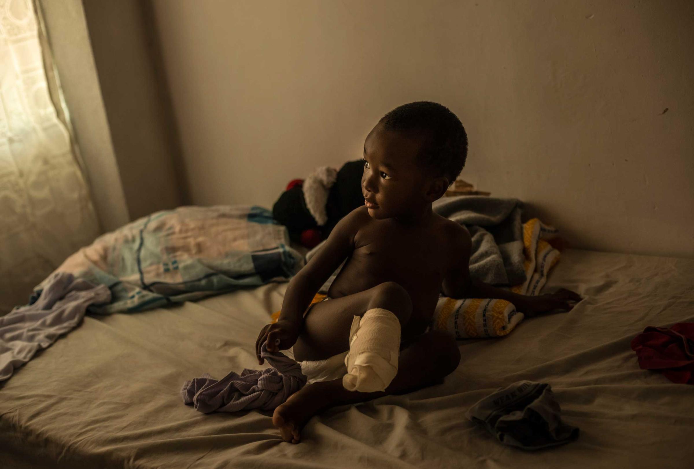 Richard, 2, who had to have his leg partially amputated after falling from a train, waits for a bath from his mother, Emily Bermudez, in Ixtepec, Mexico, July 7, 2014