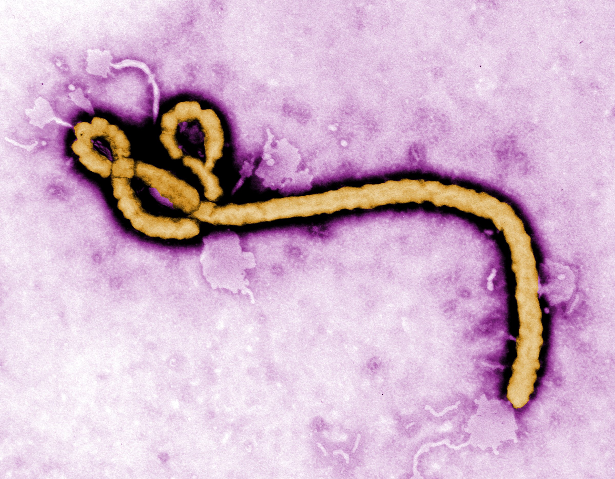 Transmission electron micrograph of Ebola virus.