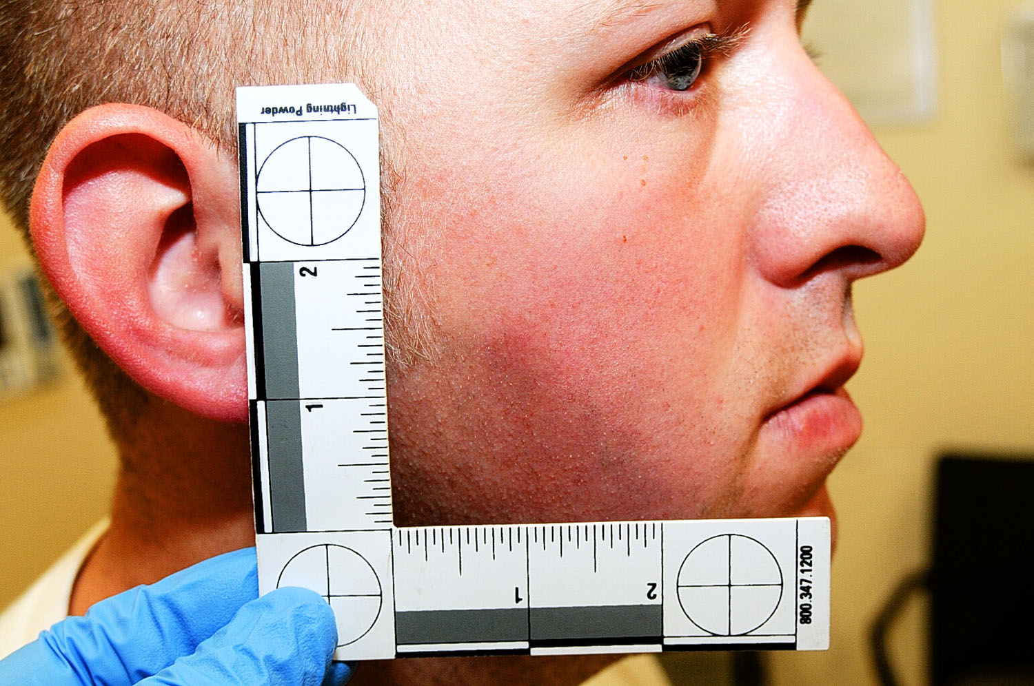 An undated evidence photograph made available by the St. Louis County prosecutors office on Nov. 25, 2014 shows Ferguson police officer Darren Wilson during his medical examination after the shooting of Michael Brown.