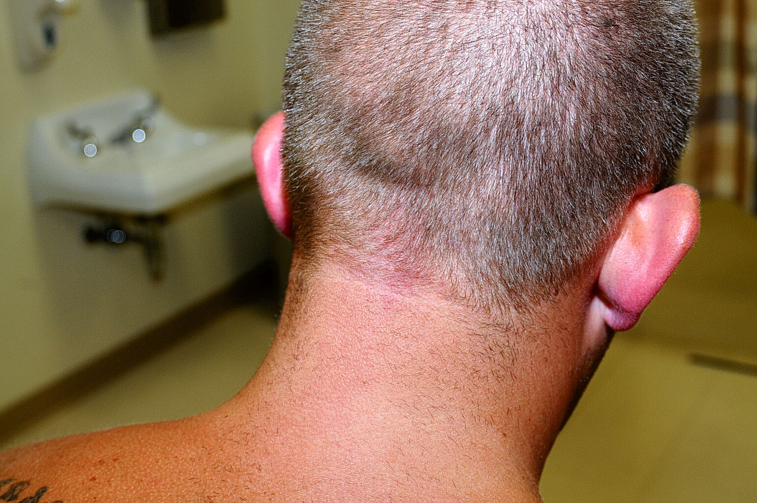 Medical examination also found cuts on the back of Officer Wilson's head