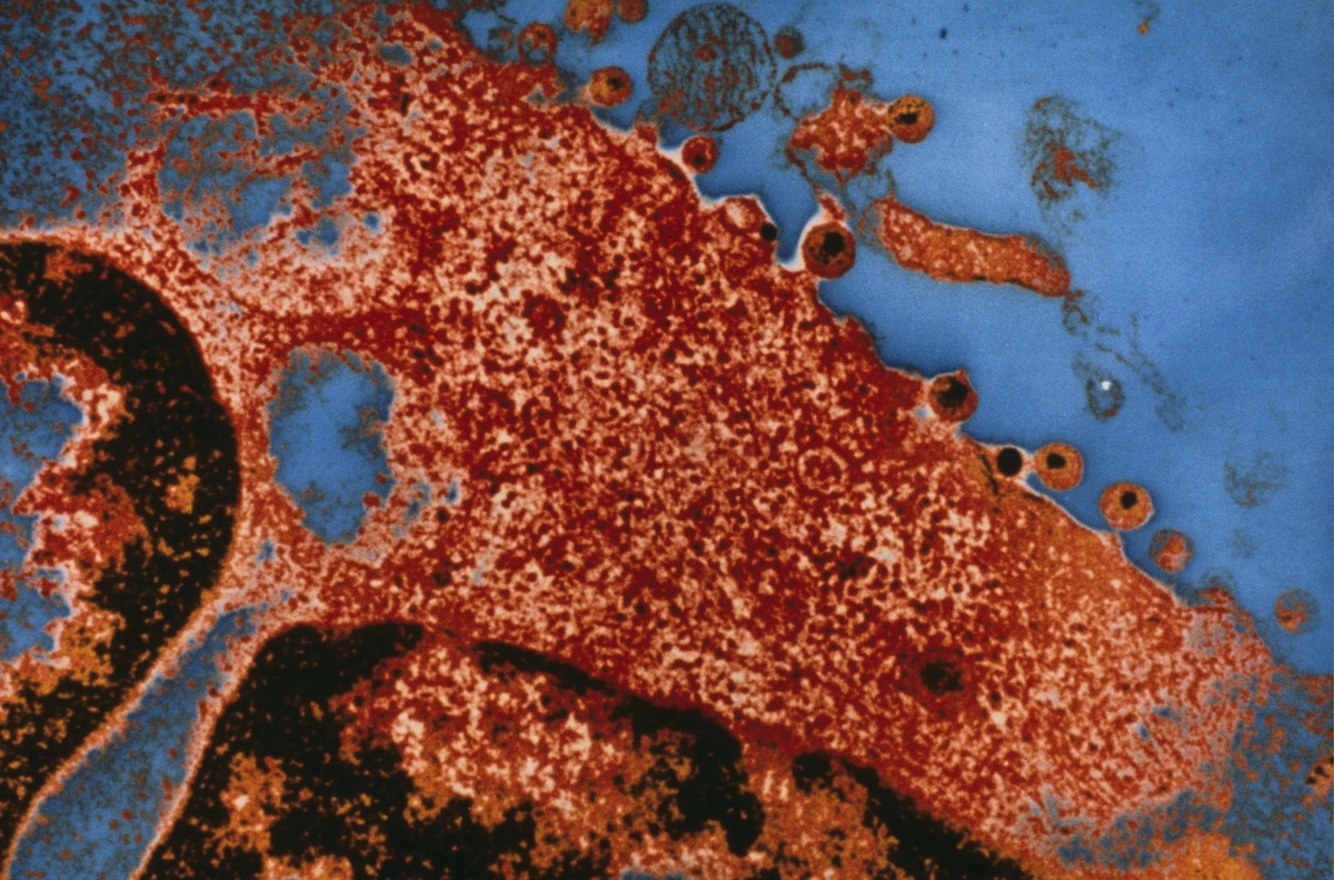 Microscope  view of HIV, 1985 (Michel Setboun—Gamma-Rapho / Getty Images)