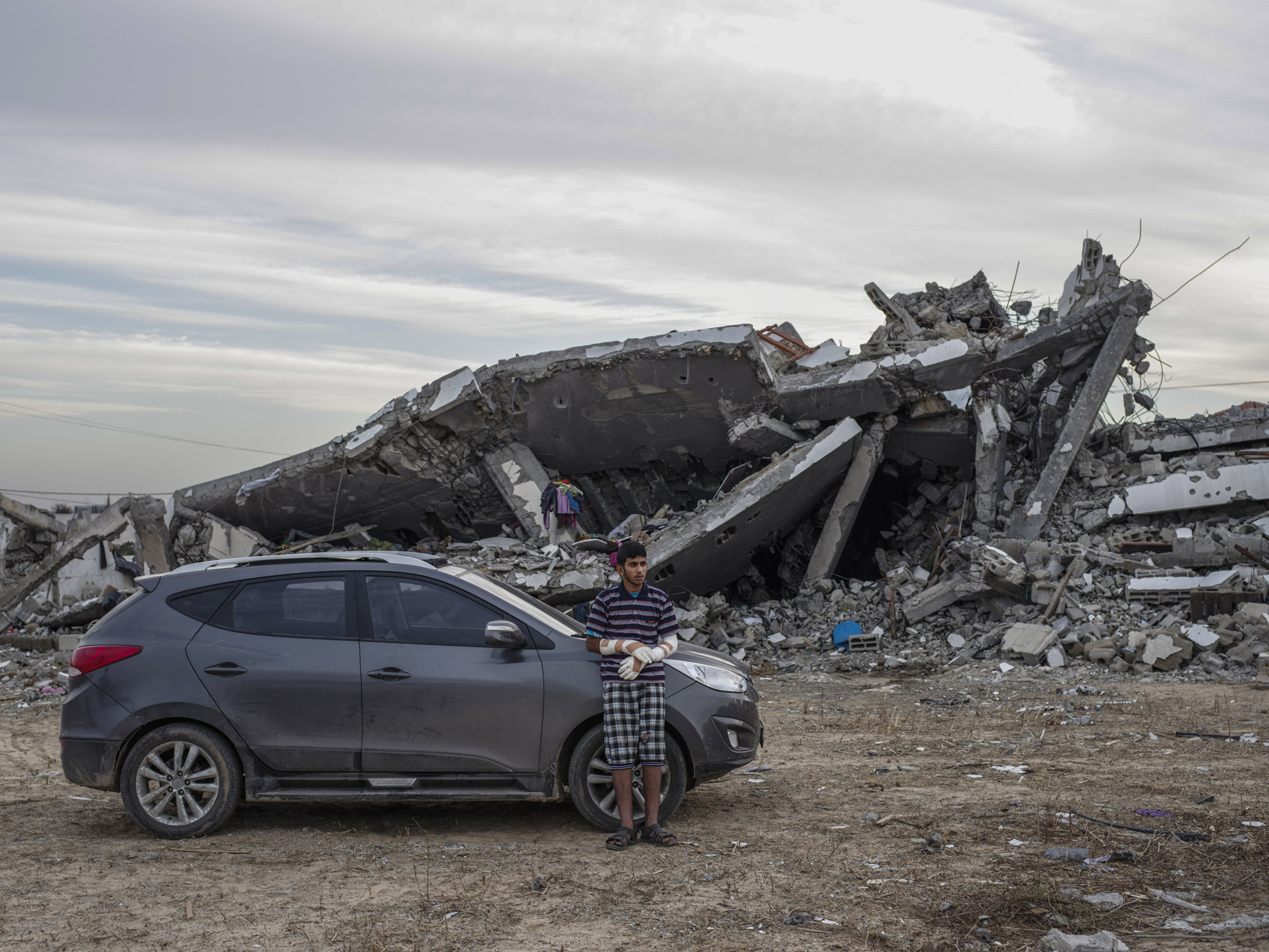 Motaz Abu Aser, who badly injured both hands in an airstrike in the destroyed Shujai'iya neighborhood, Gaza.