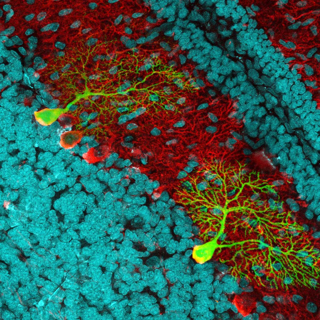 A sagittal brain slice showing cell nuclei at 40x magnification.