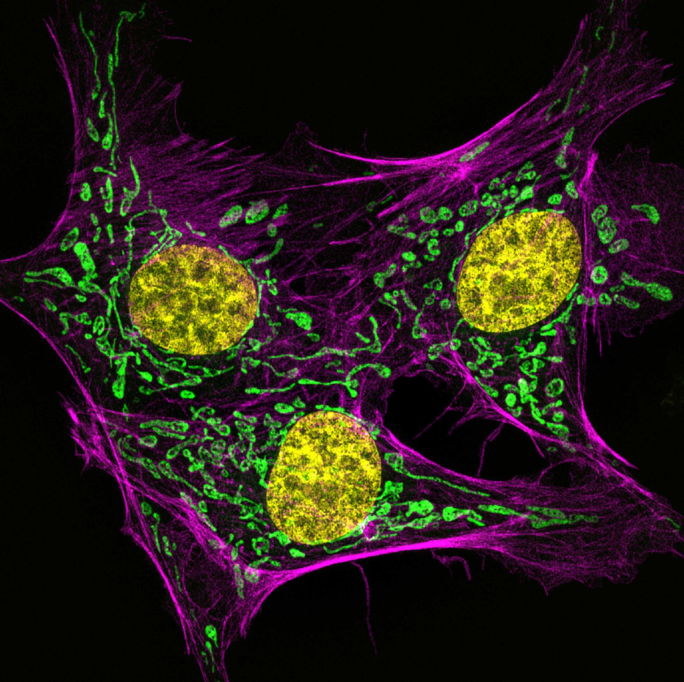 Bovine pulmonary artery endothelial cells stained for actin (pink), mitochondria (green) and DNA (yellow