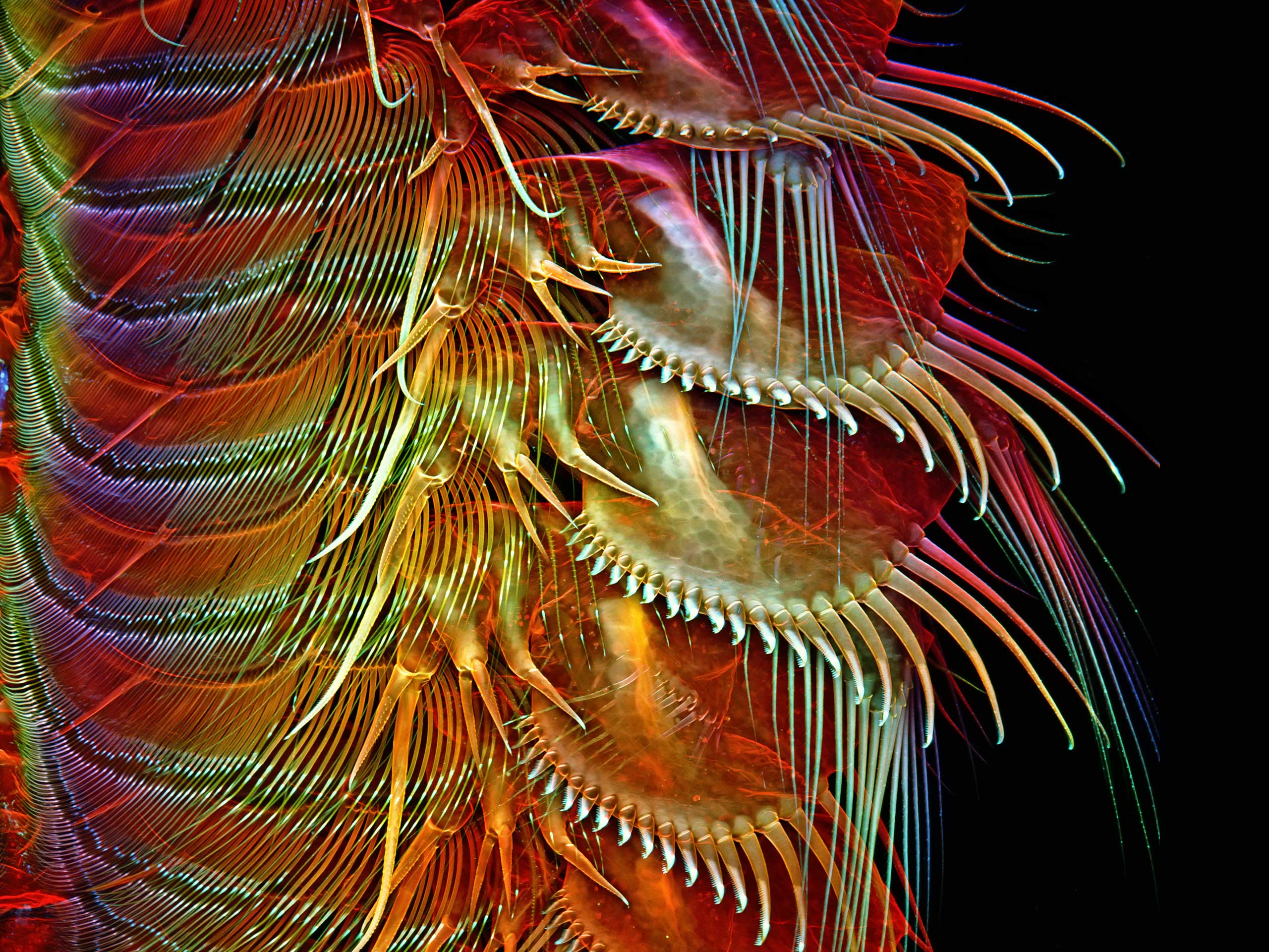 Appendages of a common brine shrimp at 100x magnification.
