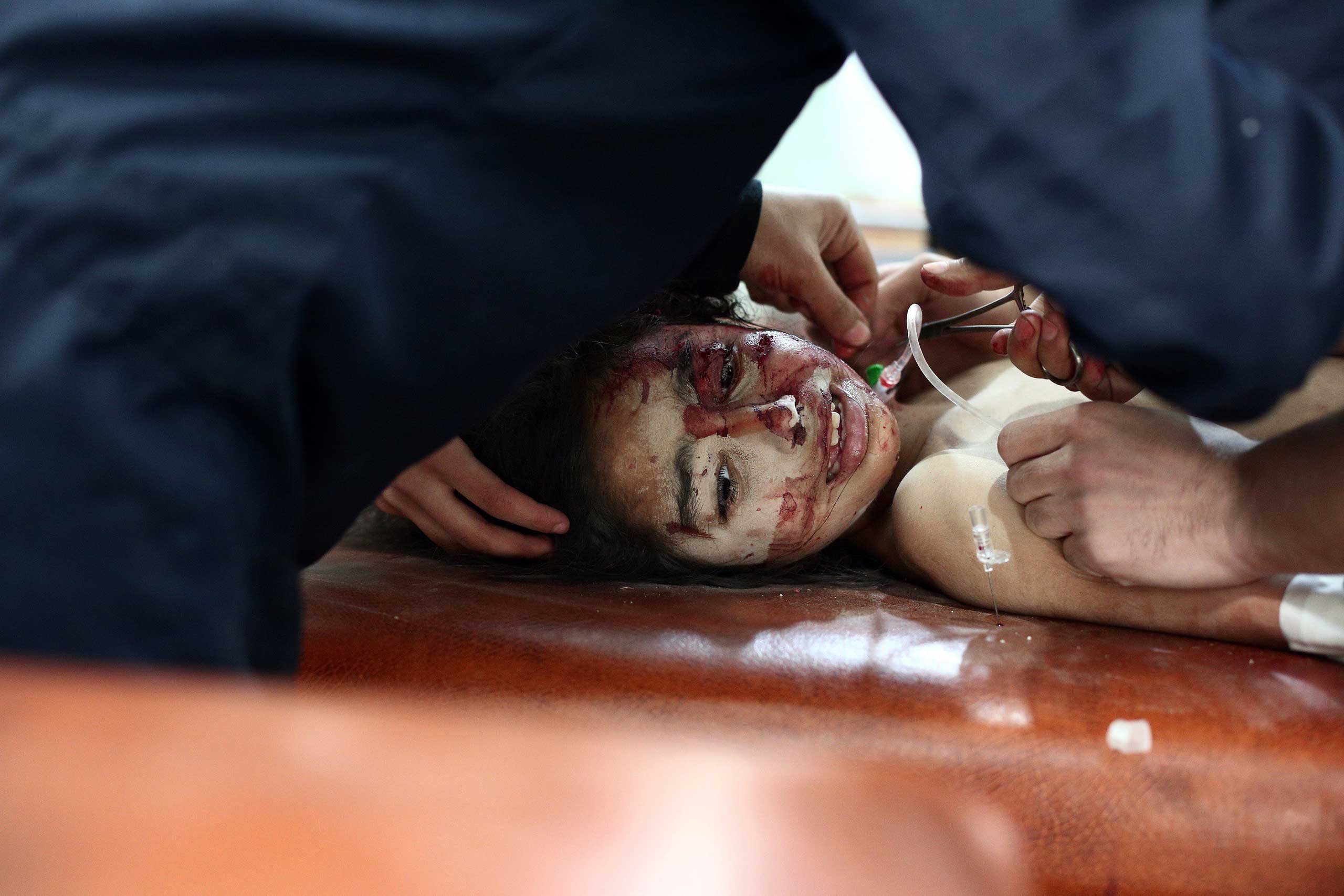 Nov. 7, 2014. A Syrian girl is treated at a make-shift hospital, following a reported regime air raid in Eastern al-Ghouta, a rebel-held region outside the capital Damascus.